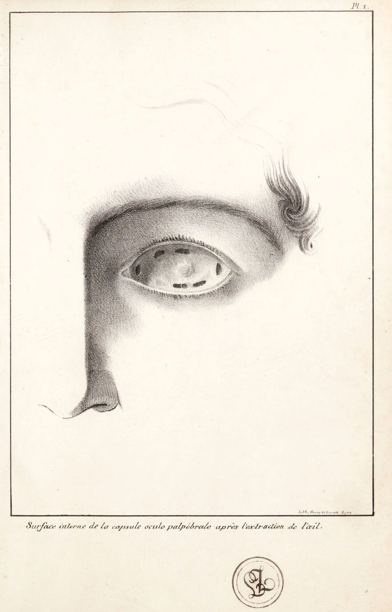 PI +. Luith, Henry ét Scorck. Lyon . on de l'œil. l'extra res Surface interne de La capsale oculo palpébrale ap