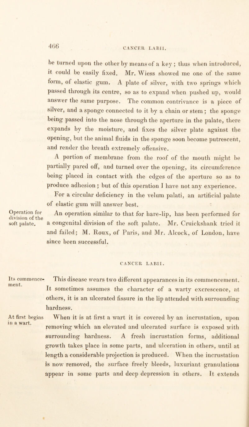 CANCER LABI I. Operation for division of the soft palate. Its commence- ment. At first begins in a wart. be turned upon the other by means of a key; thus when introduced, it could be easily fixed. Mr. Wiess showed me one of the same form, of elastic gum. A plate of silver, with two springs which passed through its centre, so as to expand when pushed up, would answer the same purpose. The common contrivance is a piece of silver, and a sponge connected to it by a chain or stem; the sponge being- passed into the nose through the aperture in the palate, there expands by the moisture, and fixes the silver plate against the opening, but the animal fluids in the sponge soon become putrescent, and render the breath extremely offensive. A portion of membrane from the roof of the mouth might be partially pared off, and turned over the opening, its circumference being placed in contact with the edges of the aperture so as to produce adhesion; but of this operation I have not any experience. For a circular deficiency in the velum palati, an artificial palate of elastic gum will answer best. - An operation similar to that for hare-lip, has been performed for a congenital division of the soft palate. Mr. Cruickshank tried it and failed; M. Roux, of Paris, and Mr. Alcock, of London, have since been successful. CANCER LABI I. This disease wears two different appearances in its commencement. It sometimes assumes the character of a warty excrescence, at others, it is an ulcerated fissure in the lip attended with surrounding hardness. When it is at first a wart it is covered by an incrustation, upon removing which an elevated and ulcerated surface is exposed with surrounding hardness. A fresh incrustation forms, additional growth takes place in some parts, and ulceration in others, until at length a considerable projection is produced. When the incrustation is now removed, the surface freely bleeds, luxuriant granulations appear in some parts and deep depression in others. It extends