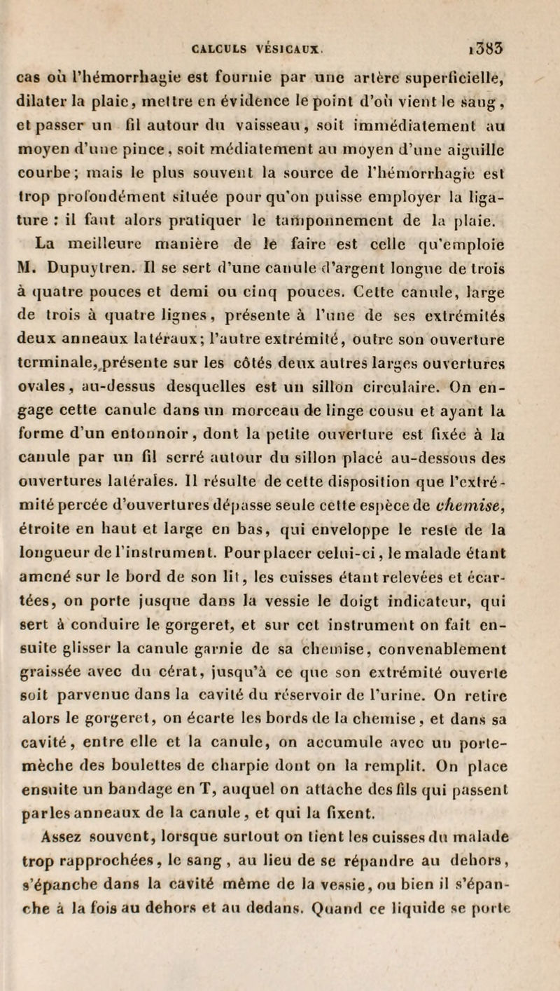 cas où l’hémorrhagie est fournie par une artère superficielle, dilater la plaie, mettre en évidence le point d’o(i vient le sang, et passer un fil autour du vaisseau, soit immédiatement au moyen d’une pince, soit médialement au moyen d’une aiguille courbe; mais le plus souvent la source de l’hémorrhagie est trop prol'ondément située pour qu'on puisse employer la liga¬ ture ; il faut alors pratiquer le tamponnement de la plaie. La meilleure manière de le faire est celle qu’emploie M. Dupuytren. Il se sert d’une canule d’argent longue de trois à quatre pouces et demi ou cinq pouces. Cette canule, large de trois à quatre lignes, présente à l’une de ses extrémités deux anneaux latéraux; l’autre extrémité, outre son ouverture terminale,,présente sur les côtés deux autres larges ouvertures ovales, au-dessus desquelles est un sillon cireulaire. On en¬ gage cette canule dans un morceau de linge cousu et ayant la forme d’un entonnoir, dont la petite ouverture est fixée à la canule par un fi! serré autour du sillon placé au-dessous des ouvertures latérales. 11 résulte de cette disposition que l’extré¬ mité percée d’ouvertures dépasse seule cette espèce de chemise, étroite en haut et large en bas, qui enveloppe le reste de la longueur de l’instrument. Pour placer celui-ci, le malade étant amené sur le bord de son lit, les cuisses étant relevées et écar¬ tées, on porte jusque dans la vessie le doigt indicateur, qui sert à conduire le gorgeret, et sur cet instrument on fait en¬ suite glisser la canule garnie de sa chemise, convenablement graissée avec du cérat, jusqu’à ce que son extrémité ouverte soit parvenue dans la cavité du réservoir de l’urine. On retire alors le gorgeret, on écarte les bords de la chemise, et dans sa cavité, entre elle et la canule, on accumule avec un porte- mèche des boulettes de charpie dont on la remplit. On place ensuite un bandage en T, auquel on attache des fils qui passent parles anneaux de la canule, et qui la fixent. Assez souvent, lorsque surtout on tient les cuisses du malade trop rapprochées, le sang , au lieu de se répandre au dehors, s’épanche dans la cavité même de la vessie, ou bien il s’épan¬ che à la fois au dehors et au dedans. Quand ce liquide se porte