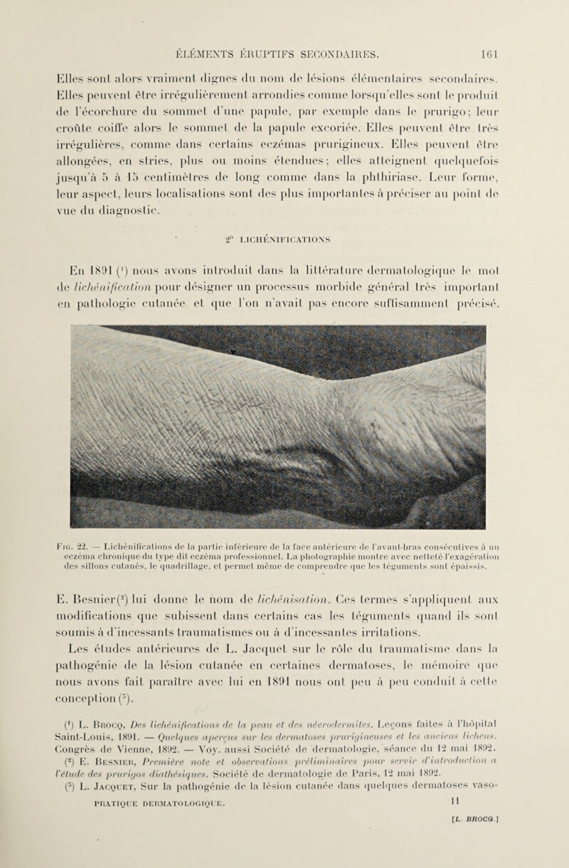 Elles sonl alors vraiment dignes du nom de lésions élémentaires secondaires. Elles peuvent être irrégulièrement arrondies comme lorsqu'elles sonl le produit de l’écorchure du sommet d’une papule, par exemple dans le prurigo; leur croûte coiffe alors le sommet de la papule excoriée. Elles peuvent être très irrégulières, comme dans certains eczémas prurigineux. Elles peuvent être allongées, en stries, plus ou moins étendues; elles atteignent quelquefois jusqu’à 5 à 15 centimètres de long comme dans la phlhiriase. Leur forme, leur aspect, leurs localisations sont des plus importantes à préciser au point de vue du diagnostic. 2 LICHÉNIFICATIONS En 1S91 (*) nous avons introduit dans la littérature dermatologique le mot de lichénification pour désigner un processus morbide général très important en pathologie cutanée et que l’on n’avait pas encore suffisamment précisé. Fig. 22. — Lichénifications de la partie inférieure de la face antérieure de l'avant-bras consécutives à un eczéma chroniquedtt type dit eczéma professionnel. La photographié montre avec netteté l’exagération des sillons cutanés, le quadrillage, et permet même de comprendre que les téguments sont épaissis. E. Besnier(2) lui donne le nom de lichénisation. Ces termes s’appliquent aux modifications que subissent dans certains cas les téguments quand ils soid soumis à d'incessants traumatismes ou à d’incessantes irritations. Les études antérieures de L. Jacquet sur le rôle du traumatisme dans la pathogénie de la lésion cutanée en certaines dermatoses, le mémoire que nous avons fait paraître avec lui en 1891 nous ont peu à peu conduit à cette conception (3). (') L. Buocq, Des lichénifications de la peau et des néorodermites. Leçons faites à l’hôpital Saint-Louis, 18111. — Quelques aperçus sur les dermatoses prurigineuses et les anciens lichens. Congrès de Vienne, 1892. — Voy. aussi Société de dermatologie, séance du 12 mai 1892. (-) E. Besnier, Première note et observations préliminaires pour servir d'introduction a l'étude des prurigos diathésiques. Société de dermatologie de Paris, 12 mai 1892. (5) L. Jacquet, Sur la pathogénie de la lésion cutanée dans quelques dermatoses vaso- PRATIQUE DERMATOLOGIQUE. H