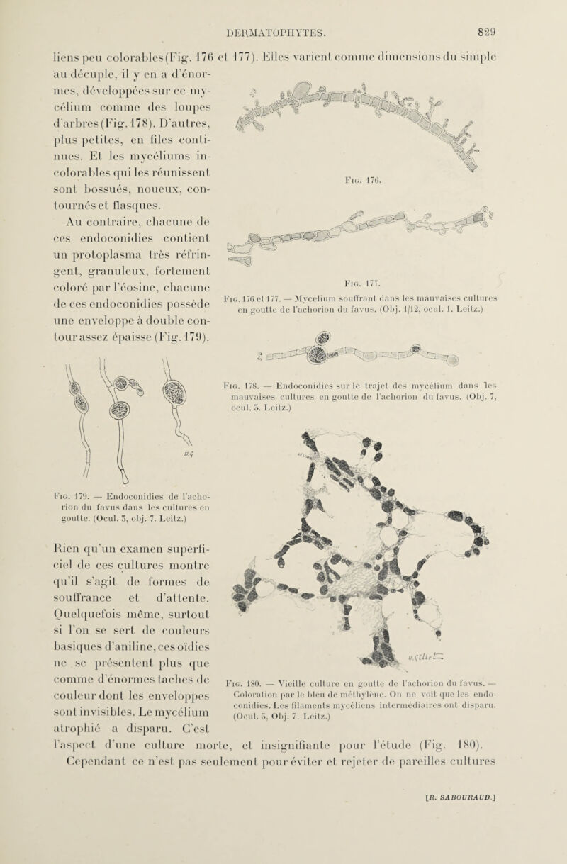 177). Elles varient comme dimensions du simple Fig. 177. Fig. 176 et 177. — Mycélium souffrant dans les mauvaises cultures en goutte de l’achorion du favus. (Obj. 1/12, ocul. 1. Leilz.) Fig. 178. — Endoconidies sur le trajet des mycélium dans les mauvaises cultures en goutte de l’achorion du favus. (Obj. 7, ocul. 3. Leilz.) liens peu colorables(Fig. 170 e au décuple, il y en a d’énor¬ mes, développées sur ce my¬ célium comme des loupes d’arbres (Fig. 178). D’autres, plus petites, en files conti- nues. Et les mycéliums in- colorables qui les réunissent sont bossués, noueux, con¬ tournés et flasques. Au contraire, chacune de ces endoconidies contient un protoplasma très réfrin¬ gent, granuleux, fortement coloré par l’éosine, chacune de ces endoconidies possède une enveloppe à double con¬ tour assez épaisse (Fig. 179). Fig. 179. — Endoconidies de l’aclio- rion du favus dans les cultures en goutte. (Ocul. 5, obj. 7. Leitz.) Rien qu’un examen superfi¬ ciel de ces cultures montre qu’il s’agit de formes de souffrance et d’attente. Quelquefois même, surtout si l’on se sert de couleurs basiques d’aniline, ces oïdies ne se présentent plus que comme d’énormes taches de couleur dont les enveloppes sont invisibles. Le mycélium atrophié a disparu. C’est l’aspect d’une culture morte, et insignifiante pour l’étude (Fig. 180) Cependant ce n’est pas seulement pour éviter et rejeter de pareilles cultures Fig. 180. — Vieille culture en goutte de l’achorion du favus.— Coloration par le bleu de méthylène. On ne voit que les endo¬ conidies. Les filaments mycéliens intermédiaires ont disparu. (Ocul. 3, Obj. 7. Leilz.)