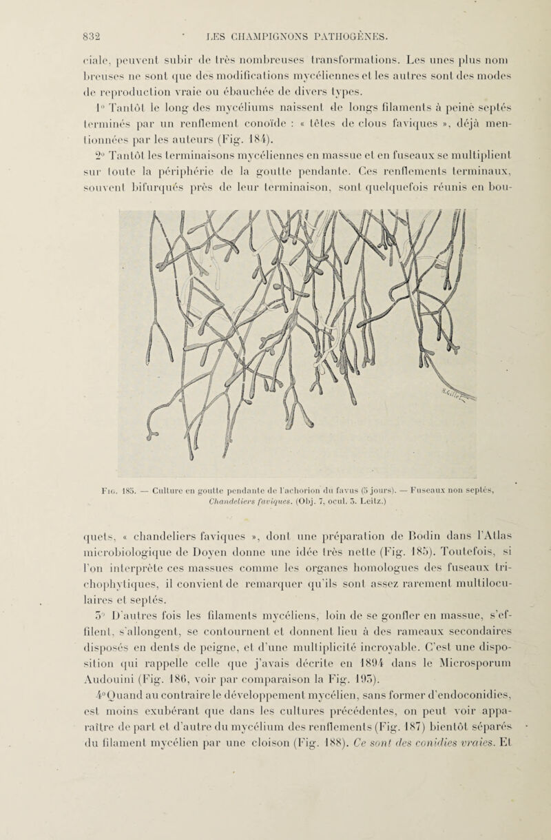 riale, peuvent subir de très nombreuses transformations. Les unes plus nom breuses ne sont que des modifications mycéliennes et les autres sont des modes de reproduction vraie ou ébauchée de divers types. 1 Tantôt le long des mycéliums naissent de longs filaments à peiné septés terminés par un renflement conoïde : « tètes de clous faviques », déjà men¬ tionnées par les auteurs (Fig. 184). 2° Tantôt les terminaisons mycéliennes en massue et en fuseaux se multiplient sur toute la périphérie de la goutte pendante. Ces renflements terminaux, souvent bifurqués près de leur terminaison, sont quelquefois réunis en bou- Fig. 185. — Culture en goutte pendante de l’achorion du favus (5 jours). — Fuseaux non septés, Chandeliers faviques. (Obj. 7, ocul. 5. Leitz.) quels, « chandeliers faviques », dont une préparation de Bodin dans l’Atlas microbiologique de Doyen donne une idée très nette (Fig. 185). Toutefois, si fou interprète ces massues comme les organes homologues des fuseaux tri- chophytiques, il convient de remarquer qu’ils sont assez rarement multilocu¬ laires et septés. 5° D'autres fois les fdaments mycéliens, loin de se gonfler en massue, s’ef- fdent, s’allongent, se contournent et donnent lieu à des rameaux secondaires disposés en dents de peigne, et d’une multiplicité incroyable. C’est une dispo¬ sition qui rappelle celle que j’avais décrite en 1894 dans le Microsporum Audouini (Fig. 186, voir par comparaison la Fig. 195). 4°Ouand au contraire le développement mycélien, sans former d’cndoconidies, est moins exubérant que dans les cultures précédentes, on peut voir appa¬ raître départ et d’autre du mycélium des renflements (Fig. 187) bientôt séparés du fdament mycélien par une cloison (Fig. 188). Ce sont des conidies vraies. EL