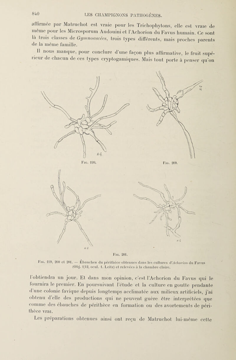 alfirmée par Malruchot est vraie pour les Trichophytons, elle est vraie de même pour les Microsporum Audouini et l’Achorion du Favus humain. Ce sont la trois classes de Gymnociscées, trois types différents, mais proches parents de la même famille. 11 nous manque, pour conclure d'une façon plus affirmative, le fruit supé¬ rieur de chacun de ces types cryptogamiques. Mais tout porte cà penser qu’on Fig. 199. Fig. 200. Fig. 201. l iG. 199, 200 et 201. — Ebauches du périthèce obtenues dans les cultures d’AchoHon du Favus (Obj. 1/12, ocul. 1. Leitz) et relevées à la chambre claire. 1 obtiendra un jour. Et dans mon opinion, c’est l'Achorion du Favus qui le fournira le premier. En poursuivant l’étude et la culture en goutte pendante d une colonie favique depuis longtemps acclimatée aux milieux artificiels, j'ai obtenu d elle des productions qui ne peuvent guère être interprétées que comme des ébauches de périthèce en formation ou des avortements de péri¬ thèce vrai. Les préparations obtenues ainsi ont reçu de Malruchot lui-même cette