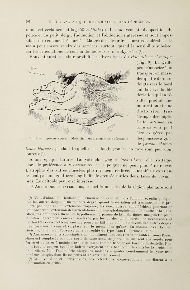 mune esl certainement la griffe cubitale (*). Les mouvemenls d’opposition du pouce et du petit doigt, l’adduction et l’abduction (interosseux) sont impos¬ sibles ou seulement ébauchés. Malgré des désordres aussi considérables, la main peut encore rendre des services, surtout quand la sensibilité subsiste, car les articulations ne sont ni douloureuses, ni ankylosées (2). Souvent aussi la main reproduit les divers types du rhumatisme chronique (Fig. 9). La griffe peut s’associera un transport en masse des quatre derniers doigts vers le bord cubital. La double déviation qui en ré¬ sulte produit une imbrication et une distorsion très étranges des doigts. Cette attitude en coup de vent peut être exagérée par des poussées aiguës de pseudo - rhuma¬ tisme lépreux, pendant lesquelles les doigts gontlés en rave sont peu dou loureux (5). Aune époque tardive, l'amyotrophie gagne Y avant-bras \ elle s’attaque alors de préférence aux extenseurs, et le poignet ne peut plus être relevé. L’atrophie des autres muscles, plus rarement réalisée, se manifeste extérieu¬ rement par une gouttière longitudinale creusée sur les deux faces de l’avant- bras. Le deltoïde peut être intéressé. 5° Aux membres inférieurs, les petits muscles de la région plantaire sont (’) C’est d’abord l’auriculaire qui s’incurve en crochet, puis l’annulaire, enfin quelque- lois les autres doigts, à un moindre degré; quand la déviation est très marquée, la pre¬ mière phalange est en extension exagérée, les deux autres sont fléchies; pourtant on peut observer 1 extension des articulations pbalango-phalanginiennes. Par suite de la dispa¬ rition des éminences thénar et hypothénar, la paume de la main figure une palette plane et même légèrement convexe, soulevée par les cordes tendineuses des fléchisseurs et par les tètes des métacarpiens. Le pouce ne fait plus sailiie au-devant des autres doigts, il rentre dans le rang et se place sur le même plan qu’eux. En somme, c’est la main simienne, telle qu’on l’observe dans l’atrophie du type Aran-Duchcnne (Fig. 8). (2) Aux mouvements supprimés s’en substituent d’autres restés possibles : ainsi l'oppo¬ sition est remplacée par une sorte de mouvement de pince. Ils suffisent aux sujets pour écrire et se livrer à maints travaux délicats, comme tricoter ou faire de la dentelle. Pen¬ dant tout le moyen âge, les ladres exerçaient dans beaucoup de contrées la profession de cordiers. Mais l’anesthésie oblige les malades è garder constamment les yeux fixés sur leurs doigts, dont ils ne peuvent se servir autrement. (s) Les synovites et périsynovites, les rétractions aponévrotiques, contribuent à la déformation en griffe.