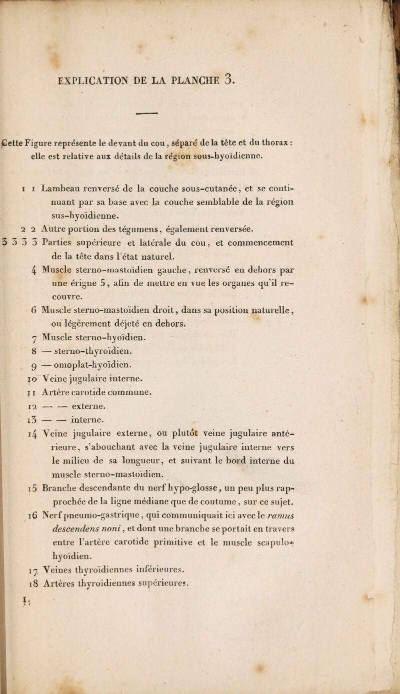 Cette Figure représente le devant du cou, séparé de la tête et du thorax : elle est relative aux détails de la région sous-hyoïdienne. 1 i Lambeau renversé de la couche sous-cutanée, et se conti¬ nuant par sa base avec la couche semblable de la région sus-hyoïdienne. 2 2 Autre portion des tégumens, également renversée. 3 5 5 3 Parties supérieure et latérale du cou, et commencement de la tête dans l’état naturel. 4 Muscle sterno-mastoïdien gauche, renversé en dehors par une érigne 5, afin de mettre en vue les organes qu’il re¬ couvre. 6 Muscle sterno-mastoïdien droit, dans sa position naturelle, ou légèrement déjeté en dehors. 7 Muscle sterno-hyoïdien. 8 — sterno-thyroïdien. 9 — omoplat-hyoïdien. 10 Veine jugulaire interne. 11 Artère carotide commune. 12 —• — externe. 13 -- interne. 14 Veine jugulaire externe, ou plutôt veine jugulaire anté¬ rieure, s’abouchant avec la veine jugulaire interne vers le milieu de sa longueur, et suivant le bord interne du muscle sterno-mastoïdien. 15 Branche descendante du nerf hypo-glosse, un peu plus rap¬ prochée de la ligne médiane que de coutume, sur ce sujet. 16 Nerf pneumo-gastrique, qui communiquait ici avec le ramus descendens noni, et dont une branche se portait en travers entre l’artère carotide primitive et le muscle scapulo^ hyoïdien. i 7 Veines thyroïdiennes inférieures. 18 Artères thyroïdiennes supérieures. !•.