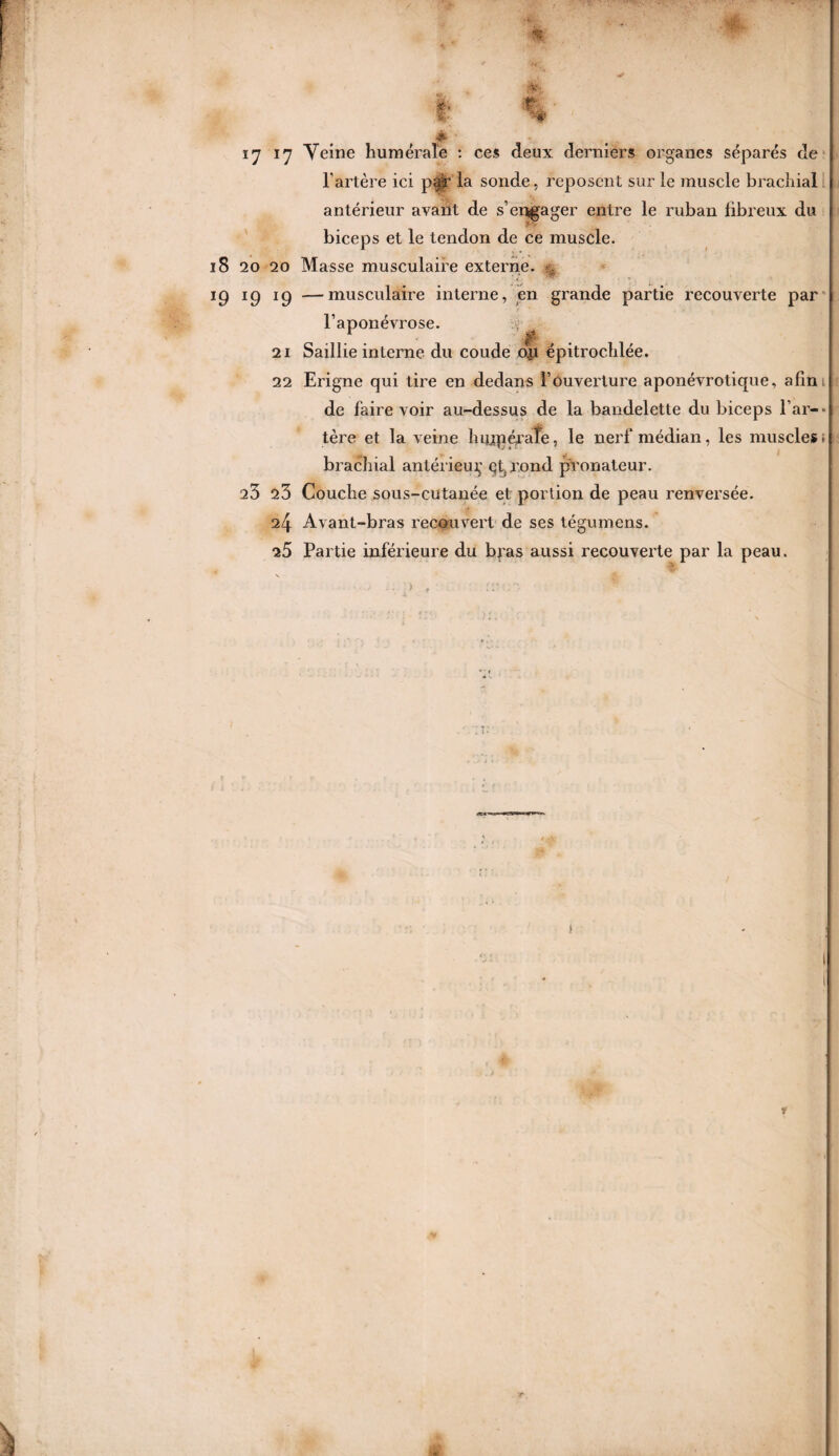 -if- 4 î7 *7 Veine humérale : ces deux derniers organes séparés de l’artère ici pa$r la sonde, reposent sur le muscle brachial antérieur avant de s’engager entre le ruban fibreux du biceps et le tendon de ce muscle. 18 20 20 Masse musculaire externe. . 19 19 19 —musculaire interne, en grande partie recouverte par l’aponévrose. 21 Saillie interne du coude op épitrochlée. 22 Erigne qui tire en dedans l’ouverture aponévrotique, afin de faire voir au-dessus de la bandelette du biceps l’ar-' 1ère et la veine hujnéraîe, le nerf médian, les muscle»; brachial antérieujç çg rond pronateur. 23 23 Couche sous-cutanée et portion de peau renversée. 24 Avant-bras recouvert de ses tégumens. 25 Partie inférieure du bras aussi recouverte par la peau. > , i I