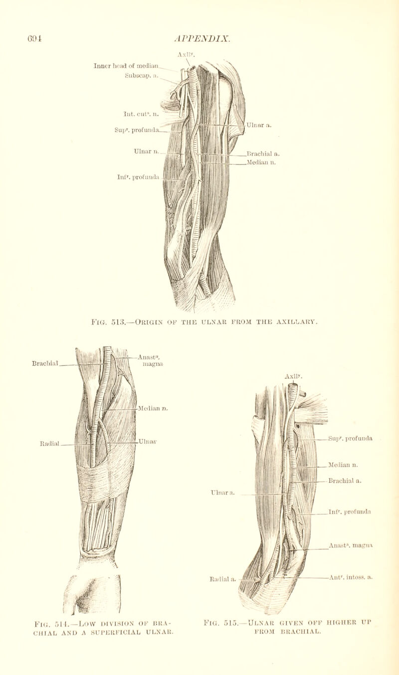 Inner bond of median Subscap. n. Int. cut”, n. Supr. profunda_ Ulnar n. Inf', profunda Fig. 513.—Origin of the ulnar from the axillary. CHIAL AND A SUPERFICIAL ULNAR. Axllr. Fig. 515. Ulnar given off higher up FROM BRACHIAL.