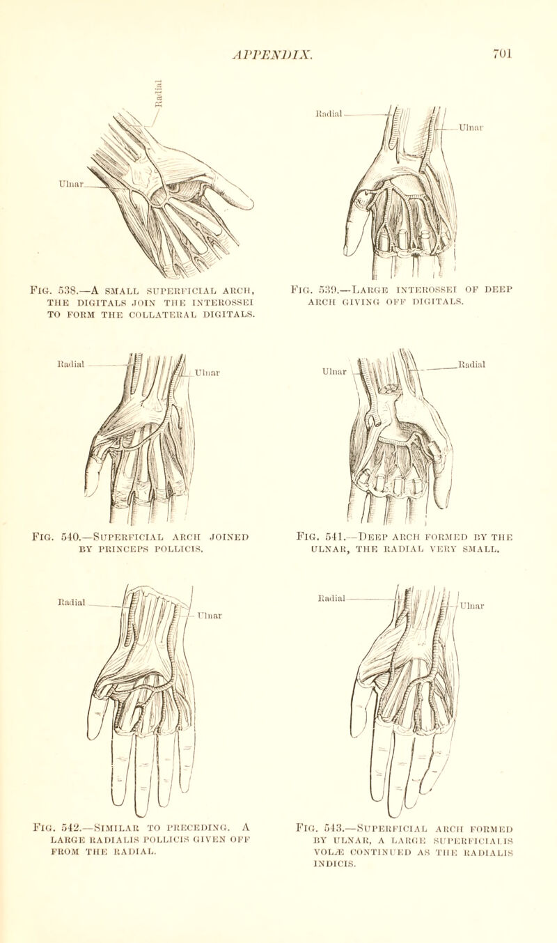 Fig. 538.—A small superficial arch, THE DIGITALS JOIN THE INTEROSSEI TO FORM THE COLLATERAL DIGITALS. Fig. 53ft.—Large interossei of deep ARCH GIVING OFF DIGITALS. Fig. 540.—Superficial arch joined BY PRINCEPS POLLICIS. Fig. 541.—Deep arch formed by the ULNAR, THE RADIAL VERY SMALL. Radial Fig. 542.—Similar to preceding. A LARGE RADIALIS POLLICIS GIVEN OFF FROM THE RADIAL. Radial - r Ulnar Fig. 543.—Superficial arch formed by ulnar, a large superficialis VOLAE CONTINUED AS THE RADIALIS INDICIS.