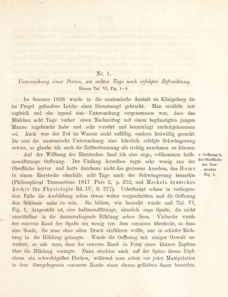 Untersuchung einer Person, am achten Tage nach erfolgter Befruchtung, Hierzu Taf. VI, Fig. 1—4. IiTL Sommer 1826 wurde in die anatomisclie Anstalt zu Königsberg die im Pregel gefundene Leiche einer Dienstmagd gebracht. Man erzählte mir sogleich und ehe irgend eine Untersuchung vorgenommen war, dass das Mädchen acht Tage vorher einen Nachmittag mit einem begünstigten jungen Manne zugebracht habe und sehr verstört und beunruhigt zurückgekommen sei. Auch war der Tod im Wasser nicht zufällig, sondern freiwillig gesucht. Da nun die anatomische Untersuchung eine kürzlich erfolgte Schwängerung erwies, so glaube ich auch die Zeitbestimmung als richtig annehmen zu können. Auf der Wölbung des Eierstockes fand ich eine enge, vollkommen halb- Oeffnungin mondförmige Oeffnung. Der Umfang derselben ragte sehr wenig aus der Oberfläche hervor und hatte durchaus nicht das gerissene Ansehen, das Home Stockes, in einem Eier stocke ebenfalls acht Tage nach der Schwängerung bemerkte i- (Philosophical Transactions 1817 Pars 2, p. 252, und Meckels deutsches Archiv für Physiologie Bd. lY, S. 277). Ueberhaupt schien in vorliegen- dem Palle die Ausbildung schon etwas weiter vorgeschritten und die Oeffnung dem Schlüsse nahe zu sein. Sie bildete, wie bemerkt wurde und Taf. YI, Eig. 1, dargestellt ist, eine halbmondförmige, ziemlich enge Spalte, die nicht unmittelbar in die darunterliegende Höhlung sehen Hess. Yielmehr wurde der convexe Eand der Spalte ein wenig von dem concaven überdeckt, so dass eine Sonde, die man ohne allen Druck einfüliren wollte, nur in schiefer Eich- tung in die Höhlung gelangte. Wurde die Oeffnung mit einiger Gewalt er- weitert, so sah man, dass der convexe Eand in Form eines kleinen Zapfens über die Höhlung vorragte. Dann erschien auch auf der Spitze dieses Zäpf- chens ein schwefelgelber Flecken, während man schon vor jeder Manipulation in dem übergebogenen concaven Eande einen ebenso gefärbten Saum bemerkte.