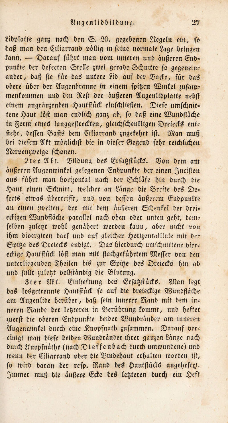 Sibpfatfe gan^ nad) ben ©. 20. gegebenen Siegeln ein, fo ba§ man ben ^iliarcanb öoßtg in feine normale i?age bringen fann. — ^Darauf fuhrt man Pom inneren unb augeren ^nbs punffe ber befecten ©teile $mei gerabe ©dhnitte fo gegenein^ anber, bag fte für ba^ untere ^ib auf ber 55ac!e, für ba^ obere über ber Üfugenbraune in einem fpigen 5Stnlel jufara^ menfommen unb ben Dveft ber augeren ^Tugenlibplattc neb(I einem angranjenben ^aufgücb einfcbliegen. ©iefe umfd)nifs tcneJ;)aut log man enblich gan$ ab, fo bag eine ^ßunbgadhe in gorm’ erne^ langgegrecften, gleichfd)enfligen SDreiecl^ ent? fteht, beffen ^agö bem ^iliarranb jugefe()rt ig. 3Öian mug bei biefem 5lft mbglid)g bie in biefer 0egenb fehr reichlichen S^eroensmetge fchonen. 2ter 51 ft. Gilbung beß ^rfaggücf^. 55on bem am augeren STugenminfel gelegenen 0nbpunfte ber einen 3ncigon au^ führt man hi^t^tjontal nach ber ©dhlafe hin burd) bie .^aut einen ©chnitt, welcher an £dnge bie 23refte beö 2^e^ feetö etma^ übertrijft, unb non bejgen augerem ^nbpunfte an einen ^meiten, ber mit bem augeren ©chenfel ber brei^ eefigen ^unbgdche parallel nad) oben ober unten geht, bem? felben jule^t mohl genähert merben fann, aber nid)t Porr ihm bibergiren barf unb auf gleid)er ^ori^ontalltnie mit ber ©pi^e beß S^reieefö enbigt. hi^»^burch umfdhnittene Pier? eefige ipautgücf log man mit gad)geführtem 5J?eg*er pon ben unterliegenben ^^heilen bi^ jur ©pige be^ Dreiecf^ hin ab unb ftiUt julegt pottgdnbig bie Blutung. Ster 5rft. 0inheffung be^ 0rfaggücf^. 5)ian legt ba^ lo^getrenntc ^autgür^ fo auf bie breieefige ?[Bunbgdche am Slugenlibe h^^nber, bag fein innerer S^anb mit bem in? neren S^anbe ber le^teren in ?5erührung fommt, unb h^ft^t juerg bie oberen Qrnbpunfte beiber 5öunbrdnber am inneren ^Tugenminfel burd) eine 5lnopfnath jufammen. ^Darauf per? einigt man biefe beiben 5öunbrdnber ihrer ganzen ^dnge nad) burd) jt'nopfndthe (nad) ^ieffenbach burd) ummunbene) unb menn ber ^iliarranb ober bie ^inbehaut erhalten morben ig/ fo mirb baran ber refp. Svanb be^ §aufgücfö angeheff^t. 3mmer mug bie dugerc €cfe bcö legteren burd) ein ^eft