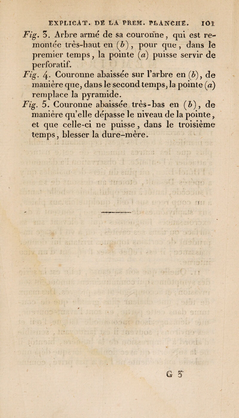 EXPLICAT. DE LA P REM. PLANCHE. ïOî Fig. 5. Arbre armé de sa couronne, qui est re¬ montée très-haut en (ô), pour que , dans le premier temps, la pointe (a) puisse servir de perforatif. Fig. 4* Couronne abaissée sur l’arbre en (&), de manière que, dans le second temps, la pointe (a) remplace la pyramide. Fig. 5. Couronne abaissée très-bas en (ô), de manière qu’elle dépasse le niveau de la pointe, et que celle-ci ne puisse, dans le troisième temps, blesser la dure-mère. ? y G 3T