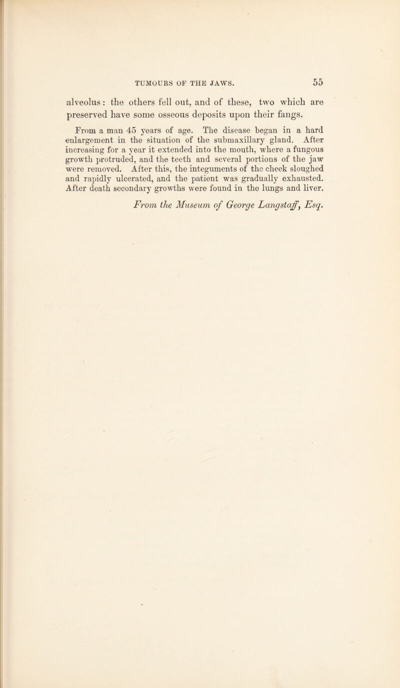 alveolus: the others fell out, and of these, two which are preserved have some osseous deposits upon their fangs. From a man 45 years of age. The disease began in a hard enlargement in the situation of the siibmaxillary gland. After increasing for a year it extended into the mouth, where a fungous growth protruded, and the teeth and several portions of the jaw were removed. After this, the integuments of the cheek sloughed and rapidly ulcerated, and the patient was gradually exhausted. After death secondary growths were found in the lungs and liver.