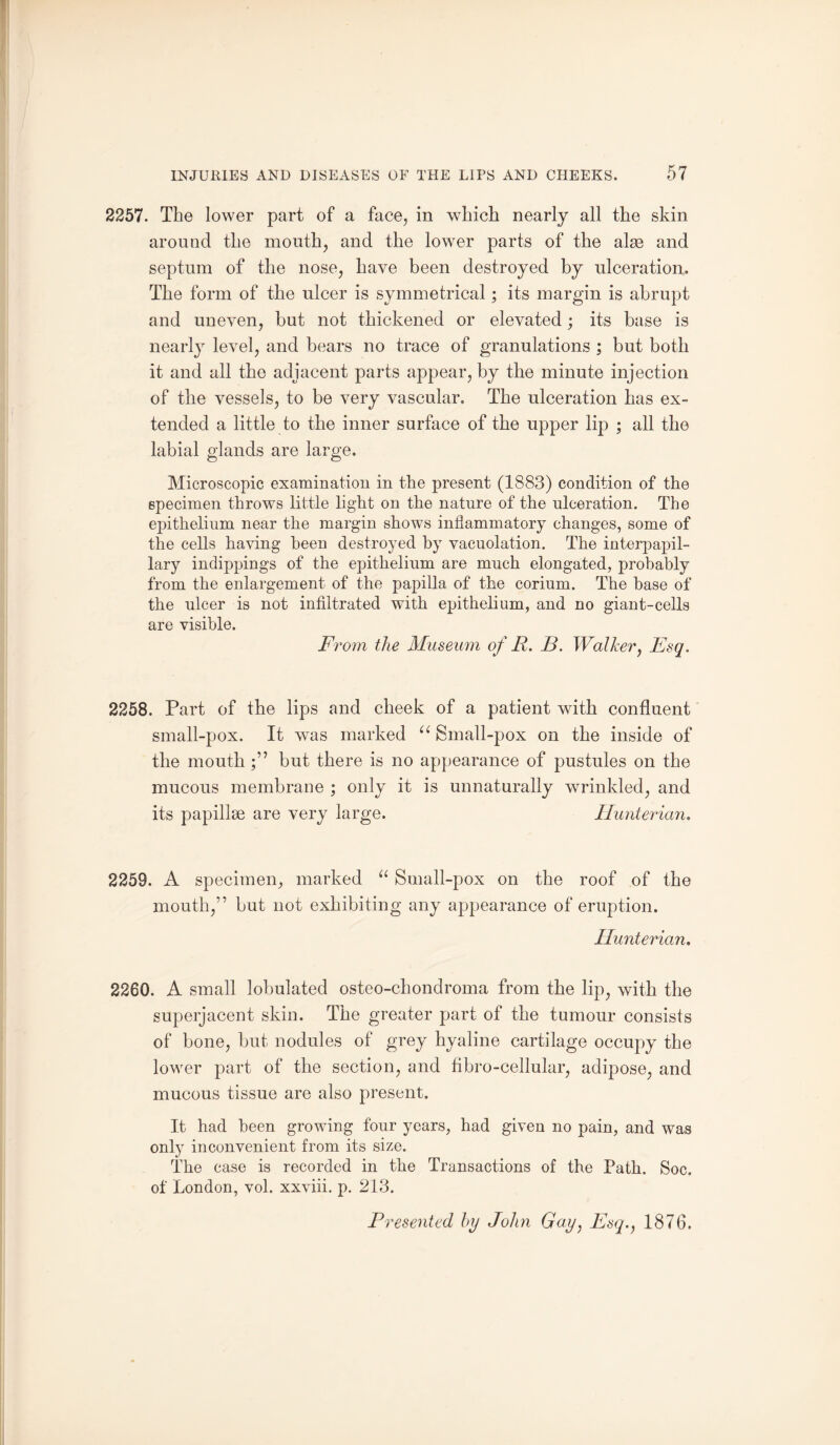 2257. The lower part of a face, in which nearly all the skin around the mouth, and the lower parts of the alas and septum of the nose, have been destroyed by ulceration,. The form of the ulcer is symmetrical; its margin is abrupt and uneven, but not thickened or elevated; its base is nearly level, and bears no trace of granulations ; but both it and all the adjacent parts appear, by the minute injection of the vessels, to be very vascular. The ulceration has ex¬ tended a little to the inner surface of the upper lip ; all the labial glands are large. Microscopic examination in the present (1883) condition of the specimen throws little light on the nature of the ulceration. The ej)ithelium near the margin shows inflammatory changes, some of the cells having been destroyed by vacuolation. The interpapil- lary indippings of the epithelium are much elongated, probably from the enlargement of the papilla of the corium. The base of the ulcer is not infiltrated with epithelium, and no giant-cells are visible. From the Museum of R. B. Walker, Esq. 2258. Part of the lips and cheek of a patient with confluent small-pox. It was marked “ Small-pox on the inside of the mouthbut there is no appearance of pustules on the mucous membrane ; only it is unnaturally wrinkled, and its papillse are very large. Hunterian. 2259. A specimen, marked u Small-pox on the roof of the mouth,” but not exhibiting any appearance of eruption. Hunterian. 2260. A small lobulated osteo-chondroma from the lip, with the superjacent skin. The greater part of the tumour consists of bone, but nodules of grey hyaline cartilage occupy the lower part of the section, and fibro-cellular, adipose, and mucous tissue are also present. It had been growing four years, had given no pain, and was only inconvenient from its size. The case is recorded in the Transactions of the Path. Soc. of London, vol. xxviii. p. 213. Presented by John Gay, Esq., 1876.