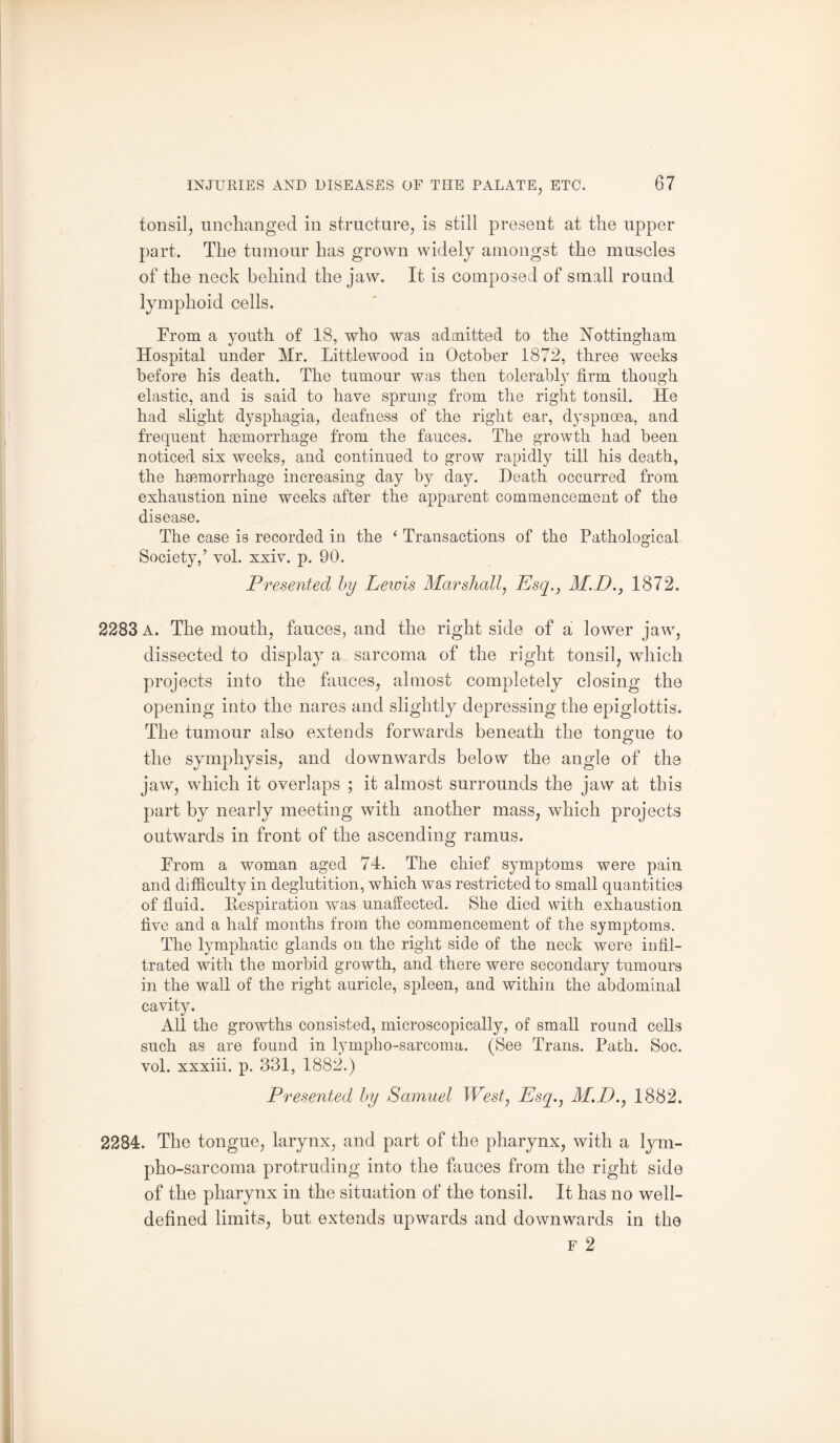 tonsil, unchanged in structure, is still present at the upper part. The tumour has grown widely amongst the muscles of the neck behind the jaw. It is composed of small round lymphoid cells. From a youth of 18, who was admitted to the Nottingham Hospital under Mr. Littlewood in October 1872, three weeks before his death. The tumour was then tolerably firm though elastic, and is said to have sprung from the right tonsil. He had slight dysphagia, deafness of the right ear, dyspnoea, and frequent haemorrhage from the fauces. The growth had been noticed six weeks, and continued to grow rapidly till his death, the haemorrhage increasing day by day. Death occurred from exhaustion nine weeks after the apparent commencement of the disease. The case is recorded in the ‘ Transactions of the Pathological Society,’ vol. xxiv. p. 90. Presented by Leiois Marshall, Esq., M.D., 1872. 2283 A. The mouth, fauces, and the right side of a lower jaw, dissected to display a sarcoma of the right tonsil, which projects into the fauces, almost completely closing the opening into the nares and slightly depressing the epiglottis. The tumour also extends forwards beneath the tongue to the symphysis, and downwards below the angle of the jaw, wdiich it overlaps ; it almost surrounds the jaw at this part by nearly meeting with another mass, which projects outwards in front of the ascending ramus. From a woman aged 74. The chief symptoms were pain and difficulty in deglutition, which was restricted to small quantities of fluid. Respiration was unaffected. She died with exhaustion five and a half months from the commencement of the symptoms. The lymphatic glands on the right side of the neck were infil¬ trated with the morbid growth, and there were secondary tumours in the wall of the right auricle, spleen, and within the abdominal cavity. All the growths consisted, microscopically, of small round cells such as are found in lympho-sarcoma. (See Trans. Path. Soc. vol. xxxiii. p. 331, 1882.) Presented by Samuel West, Esq., M.D., 1882. 2284. The tongue, larynx, and part of the pharynx, with a lym¬ pho-sarcoma protruding into the fauces from the right side of the pharynx in the situation of the tonsil. It has no well- defined limits, but extends upwards and downwards in the f 2