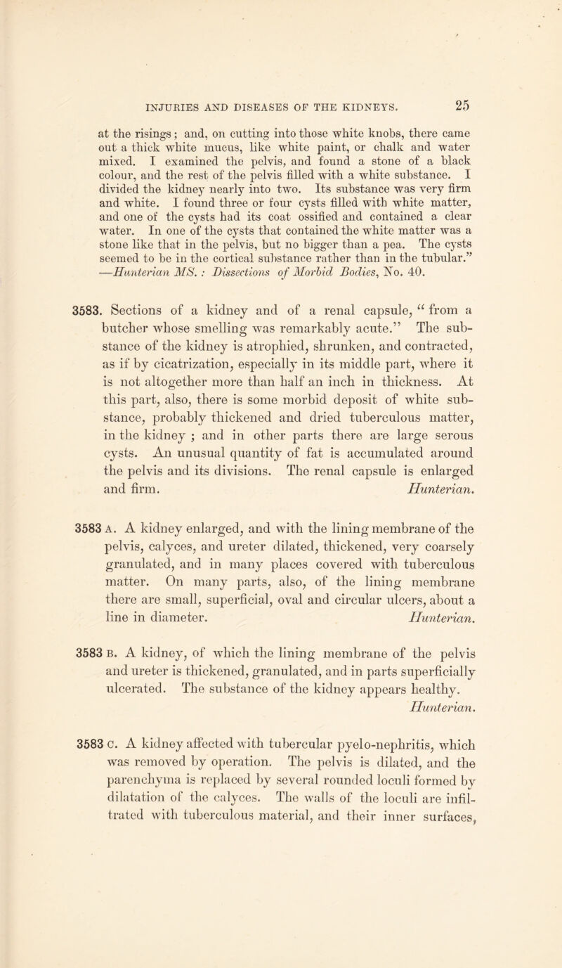 at the risings; and, on cutting into those white knobs, there came out a thick white mucus, like white paint, or chalk and water mixed. I examined the pelvis, and found a stone of a black colour, and the rest of the pelvis filled with a white substance. I divided the kidney nearly into two. Its substance was very firm and white. I found three or four cysts filled with white matter, and one of the cysts had its coat ossified and contained a clear water. In one of the cysts that contained the white matter was a stone like that in the pelvis, but no bigger than a pea. The cysts seemed to be in the cortical substance rather than in the tubular.” —Hunterian MS. : Dissections of Morbid Bodies, No. 40. 3583. Sections of a kidney and of a renal capsule, “ from a butcher whose smelling was remarkably acute.” The sub¬ stance of the kidney is atrophied, shrunken, and contracted, as if by cicatrization, especially in its middle part, where it is not altogether more than half an inch in thickness. At this part, also, there is some morbid deposit of white sub¬ stance, probably thickened and dried tuberculous matter, in the kidney ; and in other parts there are large serous cysts. An unusual quantity of fat is accumulated around the pelvis and its divisions. The renal capsule is enlarged and firm. Hunterian. 3583 a. A kidney enlarged, and with the lining membrane of the pelvis, calyces, and ureter dilated, thickened, very coarsely granulated, and in many places covered with tuberculous matter. On many parts, also, of the lining membrane there are small, superficial, oval and circular ulcers, about a line in diameter. Hunterian. 3583 B. A kidney, of ’which the lining membrane of the pelvis and ureter is thickened, granulated, and in parts superficially ulcerated. The substance of the kidney appears healthy. Hunterian. 3583 c. A kidney affected with tubercular pyelo-nephritis, which was removed by operation. The pelvis is dilated, and the parenchyma is replaced by several rounded loculi formed by dilatation of the calyces. The walls of the loculi are infil¬ trated with tuberculous material, and their inner surfaces,