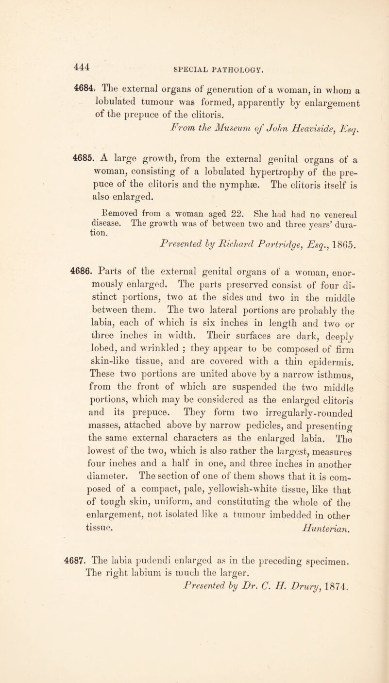 4684. The external organs of generation of a woman, in whom a lobulated tumour was formed, apparently by enlargement of the prepuce of the clitoris. From the Museum of John Heavisicle, Esq. 4685. A large growth, from the external genital organs of a woman, consisting of a lobulated hypertrophy of the pre¬ puce of the clitoris and the nymphse. The clitoris itself is also enlarged. . Removed from a woman aged 22. She had had no venereal disease. The growth was of between two and three years’ dura¬ tion. Presented by Richard Partridge, Esq., 1865. 4686. Parts of the external genital organs of a woman, enor¬ mously enlarged. The parts preserved consist of four di¬ stinct portions, two at the sides and two in the middle between them. The two lateral portions are probably the labia, each of which is six inches in length and two or three inches in width. Their surfaces are dark, deeply lobed, and wrinkled ; they appear to be composed of firm skin-like tissue, and are covered with a thin epidermis. These two portions are united above by a narrow isthmus, from the front of which are suspended the two middle portions, which may be considered as the enlarged clitoris and its prepuce. They form two irregularly-rounded masses, attached above by narrow pedicles, and presenting the same external characters as the enlarged labia. The lowest of the two, wThich is also rather the largest, measures four inches and a half in one, and three inches in another diameter. The section of one of them sho'ws that it is com¬ posed of a compact, pale, yellowish-white tissue, like that of tough skin, uniform, and constituting the whole of the enlargement, not isolated like a tumour imbedded in other tissue. Hunterian. 4687. The labia pudendi enlarged as in the preceding specimen. The right labium is much the larger. Presented by Dr. C. H. Drury, 1874.