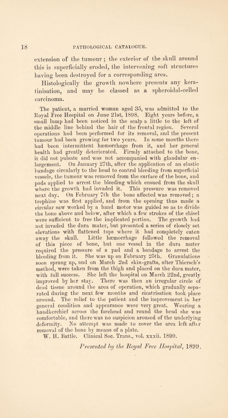 extension of the tumour ; the exterior of the skull around this is superficially eroded, the intervening soft structures having been destroyed for a corresponding area. Histologically the growth nowhere presents any kera- tinisation, and may be classed as a spheroidal-celled carcinoma. The patient, a married woman aged 35, was admitted to the ]loyal Free Hospital on June 21st, 1898. Eight years before, a small lump had been noticed in the scalp a little to the left of the middle line behind the hair of the frontal region. Several operations had been performed for its removal, and the present tumour had been growing for two years. In some months there had been intermittent haemorrhage from it, and her general health had greatly deteriorated. Eirmly attached to the bone, it did not pulsate and was not accompanied with glandular en¬ largement. On January 27th, after the application of an elastic bandage circularly to the head to control bleeding from superficial vessels, the tumour was removed from the surface of the bone, and pads applied to arrest the bleeding which ensued from the skull wit ere the growth had invaded it. This pressure was removed next day. On February 7th the bone affected was removed; a trephine was first applied, and from the opening thus made a circular saw worked by a hand motor was guided so as to divide the bone above and below, after which a few strokes of the chisel were sufficient to free the implicated portion. The growth had not invaded the dura mater, but presented a series of closely set elevations with flattened tops where it had completely eaten away the skull. Little haemorrhage followed the removal of this piece of bone, but one vessel in the dura mater required the pressure of a pad and a bandage to arrest the bleeding from it. She was up on February 25th. Granulations soon sprang up, and on March 2nd skin-grafts, after Thiersch’s method, were taken from the thigh and placed on the dura mater, with lull success. She left the hospital on March 22nd, greatly improved by her stay. There was then an irregular circle of dead tissue around the area of operation, which gradually sepa¬ rated during the next few months and cicatrisation took place around. The relief to the patient and the improvement in her general condition and appearance were very great. Wearing a handkerchief across the forehead and round the head she was comfortable, and there was no suspicion aroused of the underlying deformity. No attempt was made to cover the area left after removal of the bone by means of a plate. W. H. Tattle. Clinical Soc. Trans., vol. xxxii. 1899. Presented by the Poyal Free Hospital, 1899.