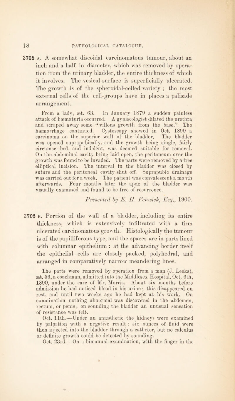 3705 A. A somewhat discoidal carcinomatous tumour, about an inch and a half in diameter, which was removed by opera¬ tion from the urinary bladder, the entire thickness of which it involves. The vesical surface is superficially ulcerated. The growth is of the spheroidal-celled variety ; the most external cells of the cell-groups have in places a palisade arrangement. From a lady, set. 63. In January 1879 a sudden painless attack of hsematuria occurred. A gynaecologist dilated the urethra and scraped away some “ villous growth from the base/3 The haemorrhage continued. Cystoscopy showed in Oct. 1899 a carcinoma on the superior wall of the bladder. The bladder was opened suprapubically, and the growth being single, fairly circumscribed, and indolent, was deemed suitable for removal. On the abdominal cavity being laid open, the peritoneum over the growth was found to be invaded. The parts were removed by a free elliptical incision. The interval in the bladder was closed by suture and the peritoneal cavity shut off. Suprapubic drainage was carried out for a week. The patient was convalescent a month afterwards. Four months later the apex of the bladder was visually examined and fouud to be free of recurrence. Presented by E. PI. Fenwick, Esq., 1900. 3705 B, Portion of the wall of a bladder, including its entire thickness, which is extensivelv infiltrated with a firm ulcerated carcinomatous growth. Histologically the tumour is of the papilliferous type, and the spaces are in parts lined with columnar epithelium : at the advancing border itself the epithelial cells are closely packed, polyhedral, and arranged in comparatively narrow meandering lines. The parts were removed by operation from a man (J. Leeks), set. 56, a coachman, admitted into the Middlesex Hospital, Oct. 6th, 1899, under the care of Mr. Morris. About six months before admission he had noticed blood in his urine ; this disappeared on rest, and until two weeks ago he had kept at his work. On examination nothing abnormal was discovered in the abdomen, rectum, or penis; on sounding the bladder an unusual sensation of resistance was felt. Oct. 11th.—Under an ana3sthetic the kidneys were examined by palpation with a negative result; six ounces of fluid were then injected into the bladder through a catheter, but no calculus or definite growth could be detected by sounding. Oct. 23rd.— On a bimanual examination, with the finger in the