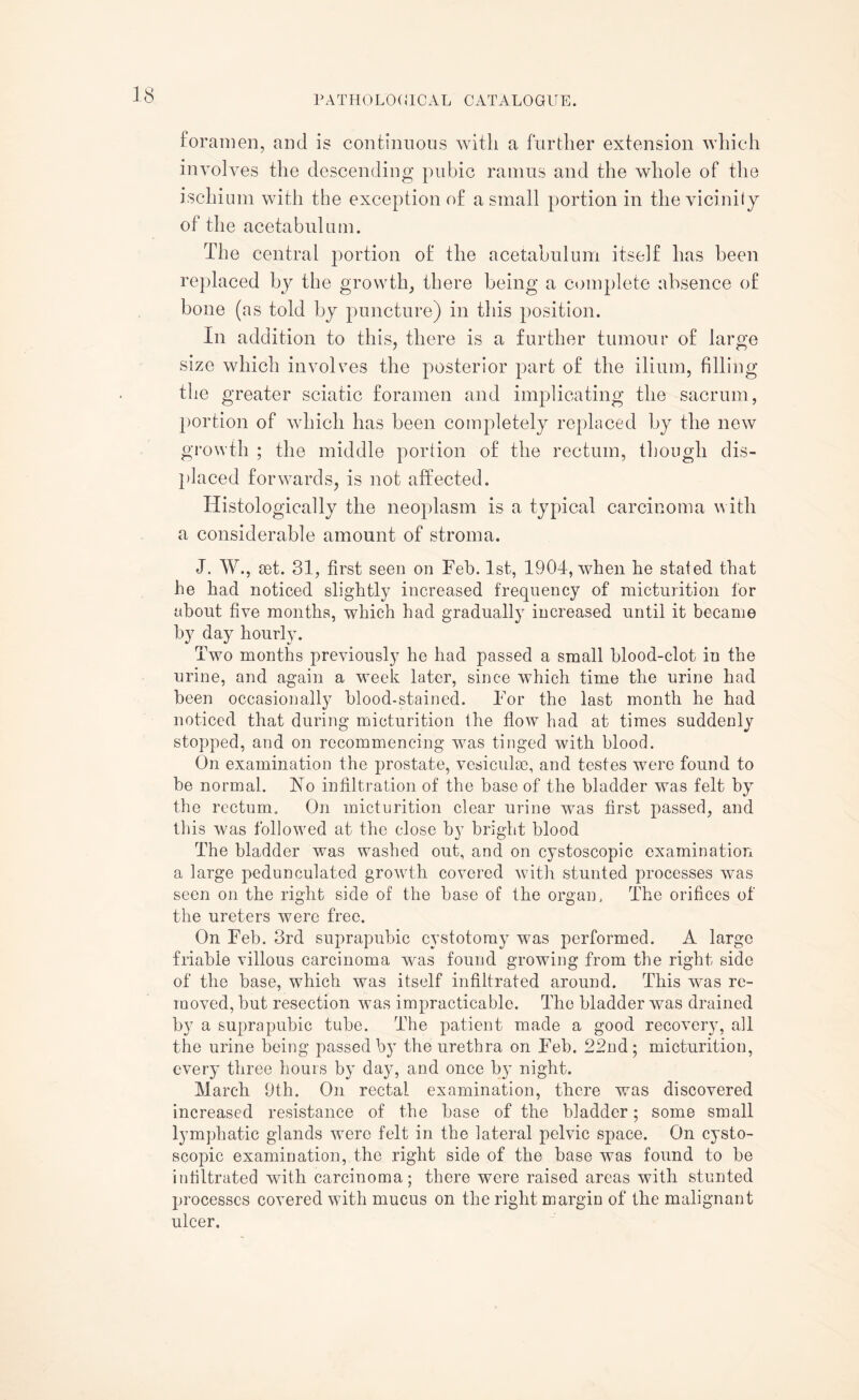 foramen, and is continuous with a further extension which involves the descending pubic ramus and the whole of the ischium with the exception of a small portion in the vicinity of the acetabulum. The central portion of the acetabulum itself has been replaced by the growth, there being a complete absence of bone (as told by puncture) in this position. In addition to this, there is a further tumour of large size which involves the posterior part of the ilium, filling the greater sciatic foramen and implicating the sacrum, portion of which has been completely replaced by the new growth ; the middle portion of the rectum, though dis¬ placed forwards, is not affected. Histologically the neoplasm is a typical carcinoma with a considerable amount of stroma. J. W., set. 31, first seen on Feb. 1st, 1904, when he stated that he had noticed slightly increased frequency of micturition for about five months, which had gradually increased until it became by day hourly. Two months previously he had passed a small blood-clot in the urine, and again a week later, since which time the urine had been occasionally blood-stained. For the last month he had noticed that during micturition the flow had at times suddenly stopped, and on recommencing was tinged with blood. On examination the prostate, vesicular, and testes were found to be normal. No infiltration of the base of the bladder was felt by the rectum. On micturition clear urine was first passed, and this was followed at the close by bright blood The bladder was washed out, and on cystoscopic examination a large pedunculated growth covered with stunted processes was seen on the right side of the base of the organ, The orifices of the ureters were free. On Feb. 3rd suprapubic cystotomy was performed. A large friable villous carcinoma was found growing from the right side of the base, which was itself infiltrated around. This was re¬ moved, but resection was impracticable. The bladder was drained by a suprapubic tube. The patient made a good recovery, all the urine being passed b}T the urethra on Feb. 22nd; micturition, every three hours by day, and once by night. March 9th. On rectal examination, there was discovered increased resistance of the base of the bladder; some small lymphatic glands were felt in the lateral pelvic space. On cysto¬ scopic examination, the right side of the base was found to be infiltrated with carcinoma; there were raised areas with stunted processes covered with mucus on the right margin of the malignant ulcer.