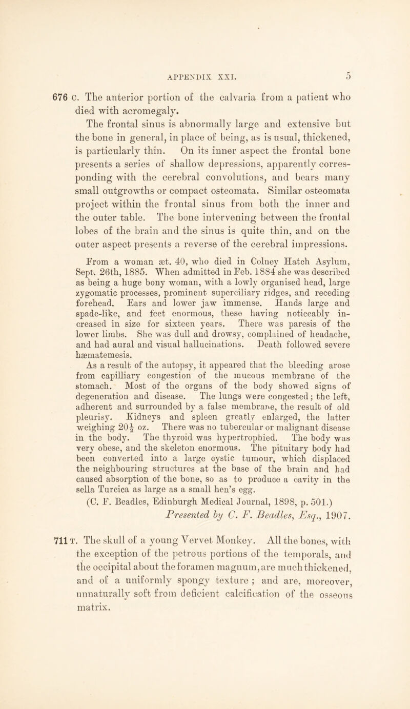 676 c. The anterior portion o£ the calvaria from a patient who died with acromegaly. The frontal sinus is abnormally large and extensive but the bone in general, in place of being, as is usual, thickened, is particularly thin. On its inner aspect the frontal bone presents a series of shallow depressions, apparently corres¬ ponding with the cerebral convolutions, and bears many small outgrowths or compact osteomata. Similar osteomata project within the frontal sinus from both the inner and the outer table. The bone intervening between the frontal lobes of the brain and the sinus is quite thin, and on the outer aspect presents a reverse of the cerebral impressions. From a woman set. 40, who died in Colney Hatch Asylum, Sept. 26th, 1885. When admitted in Feb. 1884 she was described as being a huge bony woman, with a lowly organised head, large zygomatic processes, prominent superciliary ridges, and receding forehead. Ears and lower jaw immense. Hands large and spade-like, and feet enormous, these having noticeably in¬ creased in size for sixteen years. There was paresis of the lower limbs. She was dull and drowsy, complained of headache, and had aural and visual hallucinations. Heath followed severe hsematemesis. As a result of the autopsy, it appeared that the bleeding arose from capilliary congestion of the mucous membrane of the stomach. Most of the organs of the body showed signs of degeneration and disease. The lungs were congested; the left, adherent and surrounded by a false membrane, the result of old pleurisy. Kidneys and spleen greatly enlarged, the latter weighing 20^- oz. There was no tubercular or malignant disease in the body. The thyroid was hypertrophied. The body was very obese, and the skeleton enormous. The pituitary body had been converted into a large cystic tumour, which displaced the neighbouring structures at the base of the brain and had caused absorption of the bone, so as to produce a cavity in the sella Turcica as large as a small hen’s egg. (C. F. Beadles, Edinburgh Medical Journal, 1898, p. 501.) Presented by C. F. Beadles, Esq., 1907. 711T. The skull of a young Yervet Monkey. All the bones, with the exception of the petrous portions of the temporals, and the occipital about the foramen magnum, are much thickened, and of a uniformly spongy texture ; and are, moreover, unnaturally soft from deficient calcification of the osseous matrix.