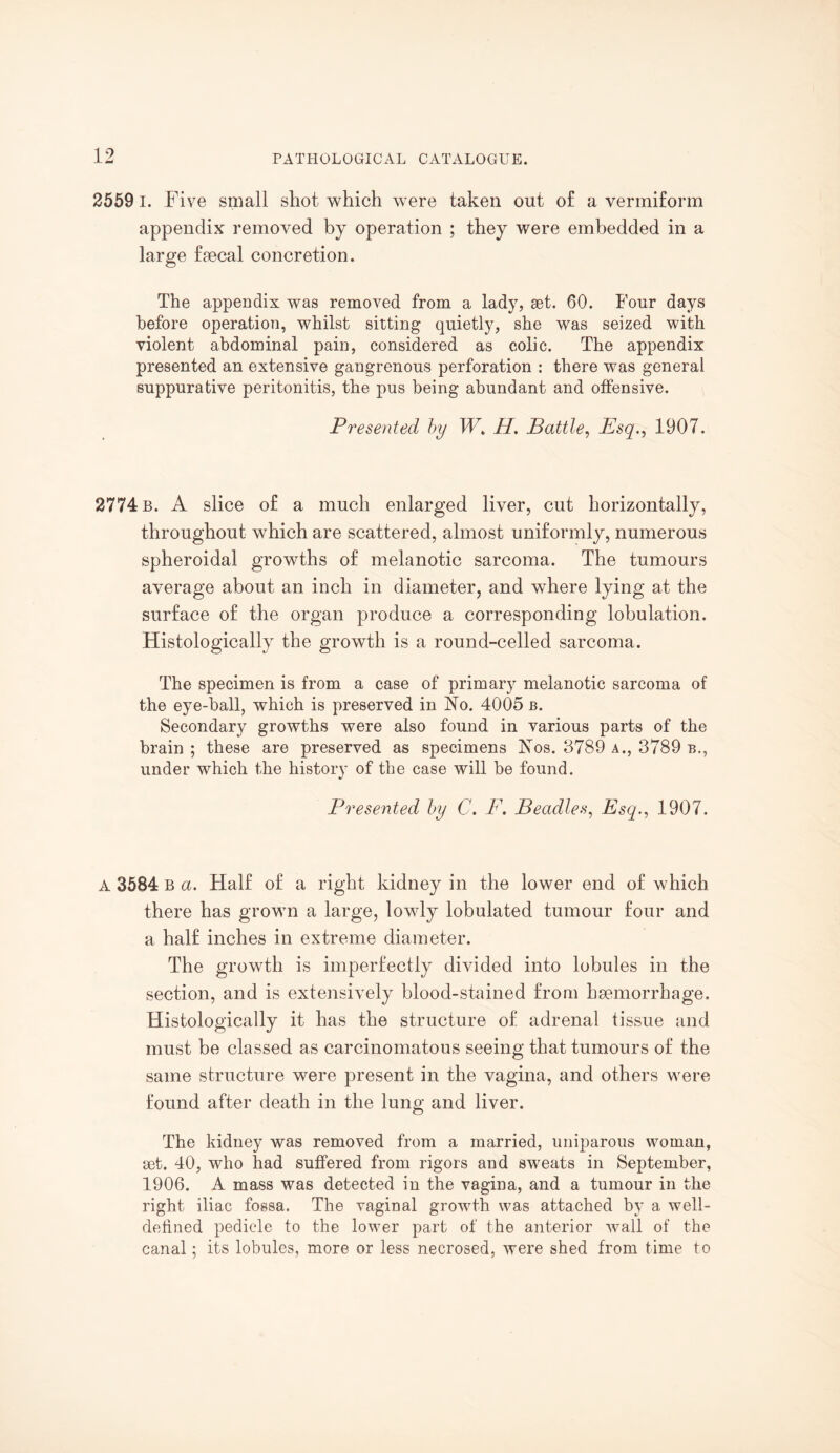 25591. Five small shot which were taken out of a vermiform appendix removed by operation ; they were embedded in a large fsecal concretion. The appendix was removed from a lady, set. 60. Four days before operation, whilst sitting quietly, she was seized with violent abdominal pain, considered as colic. The appendix presented an extensive gangrenous perforation : there was general suppurative peritonitis, the pus being abundant and offensive. Presented by W» H. Battle, Esq., 1907. 2774 b. A slice of a much enlarged liver, cut horizontally, throughout which are scattered, almost uniformly, numerous spheroidal growths of melanotic sarcoma. The tumours average about an inch in diameter, and where lying at the surface of the organ produce a corresponding lobulation. Histologically the growth is a round-celled sarcoma. The specimen is from a case of primary melanotic sarcoma of the eye-ball, which is preserved in No. 4005 b. Secondary growths were also found in various parts of the brain ; these are preserved as specimens Nos. 3789 a., 3789 b., under which the history of the case will be found. Presented by C. F. Beadles, Esq., 1907. A 3584 b a. Half of a right kidney in the lower end of which there has grown a large, lowly lobulated tumour four and a half inches in extreme diameter. The growth is imperfectly divided into lobules in the section, and is extensively blood-stained from haemorrhage. Histologically it has the structure of adrenal tissue and must be classed as carcinomatous seeing that tumours of the same structure were present in the vagina, and others were found after death in the lung and liver. The kidney was removed from a married, uniparous woman, set. 40, who had suffered from rigors and sweats in September, 1906. A mass was detected in the vagina, and a tumour in the right iliac fossa. The vaginal growth was attached by a well- defined pedicle to the lower part of the anterior wall of the canal; its lobules, more or less necrosed, were shed from time to