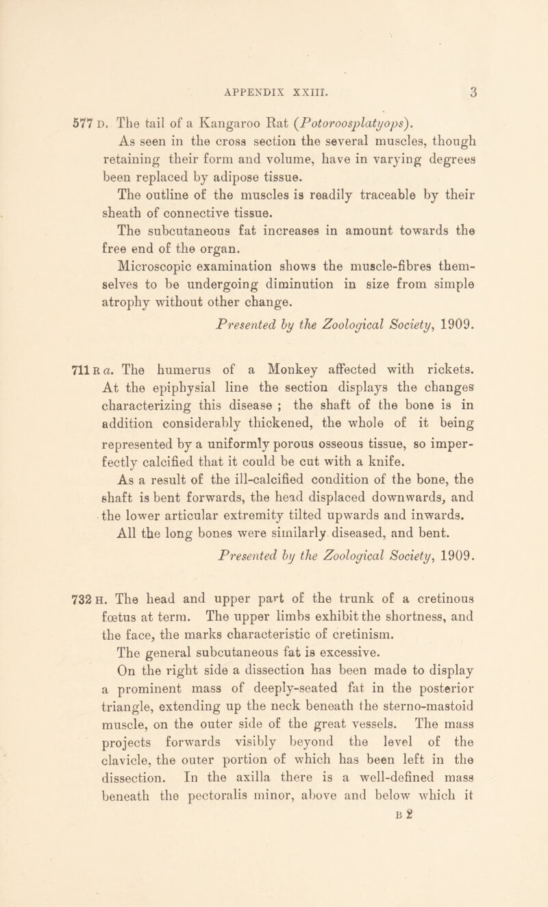 577 d, The tail of a Kangaroo Rat (Potoroosplatyops). As seen in the cross section the several muscles, though retaining their form and volume, have in varying degrees been replaced by adipose tissue. The outline of the muscles is readily traceable by their sheath of connective tissue. The subcutaneous fat increases in amount towards the free end of the organ. Microscopic examination shows the muscle-fibres them¬ selves to be undergoing diminution in size from simple atrophy without other change. Presented by the Zoological Society, 1909. 711R a. The humerus of a Monkey affected with rickets. At the epiphysial line the section displays the changes characterizing this disease ; the shaft of the bon© is in addition considerably thickened, the whole of it being represented by a uniformly porous osseous tissue, so imper¬ fectly calcified that it could be cut with a knife. As a result of the ill-calcified condition of the bone, the shaft is bent forwards, the head displaced downwards, and the lower articular extremity tilted upwards and inwards. All the long bones were similarly diseased, and bent. Presented by the Zoological Society, 1909. 732 H. The head and upper part of the trunk of a cretinous foetus at terra. The upper limbs exhibit the shortness, and the face, the marks characteristic of cretinism. The general subcutaneous fat is excessive. On the right side a dissection has been made to display a prominent mass of deeply-seated fat in the posterior triangle, extending up the neck beneath the sterno-mastoid muscle, on the outer side of the great vessels. The mass projects forwards visibly beyond the level of the clavicle, the outer portion of which has been left in the dissection. In the axilla there is a well-defined mass beneath the pectoralis minor, above and below which it b 2