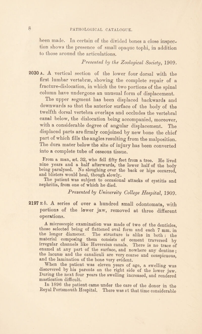 been made. In certain o£ the divided bones a close inspect tion shows the presence of small opaque tophi, in addition to those around the articulations. Presented by the Zoological Society, 1909, 2030 A. A vertical section of the lower four dorsal with the first lumbar vertebrae, showing the complete repair of a fracture-dislocation, in which the two portions of the spinal column have undergone an unusual form of displacement. The upper segment has been displaced backwards and downwards so that the anterior surface of the body of the twelfth dorsal vertebra overlaps and occludes the vertebral canal below, the dislocation being accompanied, moreover, with a considerable degree of angular displacement. The displaced parts are firmly conjoined by new bone the chief part of which fills the angles resulting from the malposition. The dura mater below the site of injury has been converted into a complete tube of osseous tissue. From a man, set. 32, who fell fifty feet from a tree. He lived nine years and a half afterwards, the lower half of the body being paralysed. Ho sloughing over the back or hips occurred, and blisters would heal, though slowly. The patient was subject to occasional attacks of cystitis and nephritis, from one of which he died. Presented by University College Hospital, 1909. 2197 e b. A series of over a hundred small odontomata, with portions of the lower jaw, removed at three different operations. A microscopic examination was made of two of the denticles, those selected being of flattened oval form and each 7 mm. in the longer diameter. The structure is alike in both : the material composing them consists of cement traversed by irregular channels like Haversian canals. There is no trace of enamel at any part of the surface, and nowhere any dentine ; the lacunae and the eanaliculi are very coarse and conspicuous,5 and the lamination of the bone very evident. Wken the patient was eleven years of age, a swelling was discovered by his parents on the right side of the lower jaw. During the next four years the swelling increased, and rendered mastication difficult. In 1896 the patient came under the care of the donor in the Koyal Portsmouth Hospital. There was at that time considerable