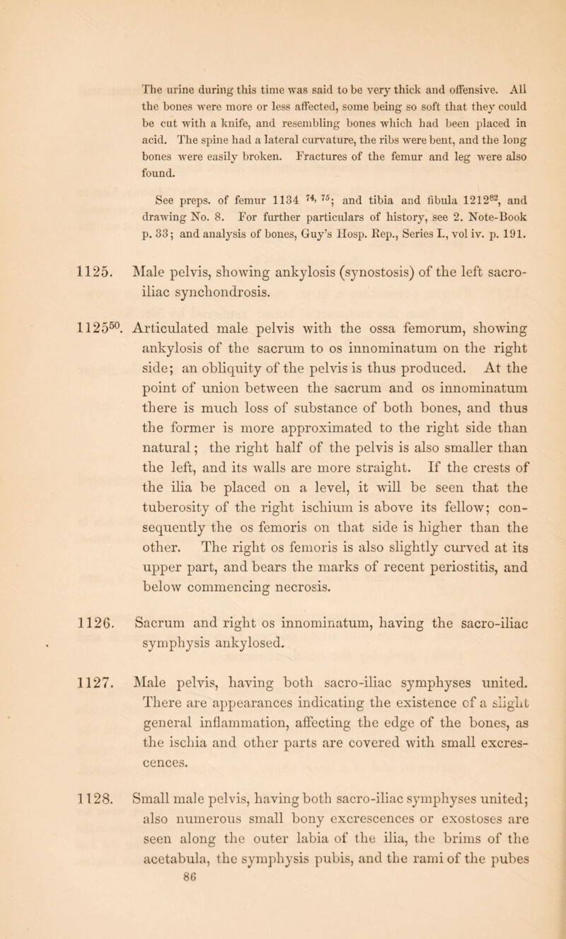 The urine during this time was said to be very thick and offensive. All the bones were more or less affected, some being so soft that they could be cut with a knife, and resembling bones which had been placed in acid. The spine had a lateral curvature, the ribs were bent, and the long bones were easily broken. Fractures of the femur and leg were also found. See preps, of femur 1134 74> 75; and tibia and fibula 12 1 282, and drawing No. 8. For further particulars of history, see 2. Note-Book p. 33; and analysis of bones, Guy’s Hosp. Rep., Series I., vol iv. p. 191. 1125. Male pelvis, showing ankylosis (synostosis) of the left sacro¬ iliac synchondrosis. 112550. Articulated male pelvis with the ossa femorum, showing ankylosis of the sacrum to os innominatum on the right side; an obliquity of the pelvis is thus produced. At the point of union between the sacrum and os innominatum there is much loss of substance of both bones, and thus the former is more approximated to the right side than natural; the right half of the pelvis is also smaller than the left, and its walls are more straight. If the crests of the ilia be placed on a level, it will be seen that the tuberosity of the right ischium is above its fellow; con¬ sequently the os femoris on that side is higher than the other. The right os femoris is also slightly curved at its upper part, and bears the marks of recent periostitis, and below commencing necrosis. 1126. Sacrum and right os innominatum, having the sacro-iliac symphysis ankylosed. 1127. Male pelvis, having both sacro-iliac symphyses iinited. There are appearances indicating the existence of a slight general inflammation, affecting the edge of the bones, as the iscliia and other parts are covered with small excres¬ cences. 1128. Small male pelvis, having both sacro-iliac symphyses united; also numerous small bony excrescences or exostoses are seen along the outer labia of the ilia, the brims of the acetabula, the symphysis pubis, and the rami of the pubes