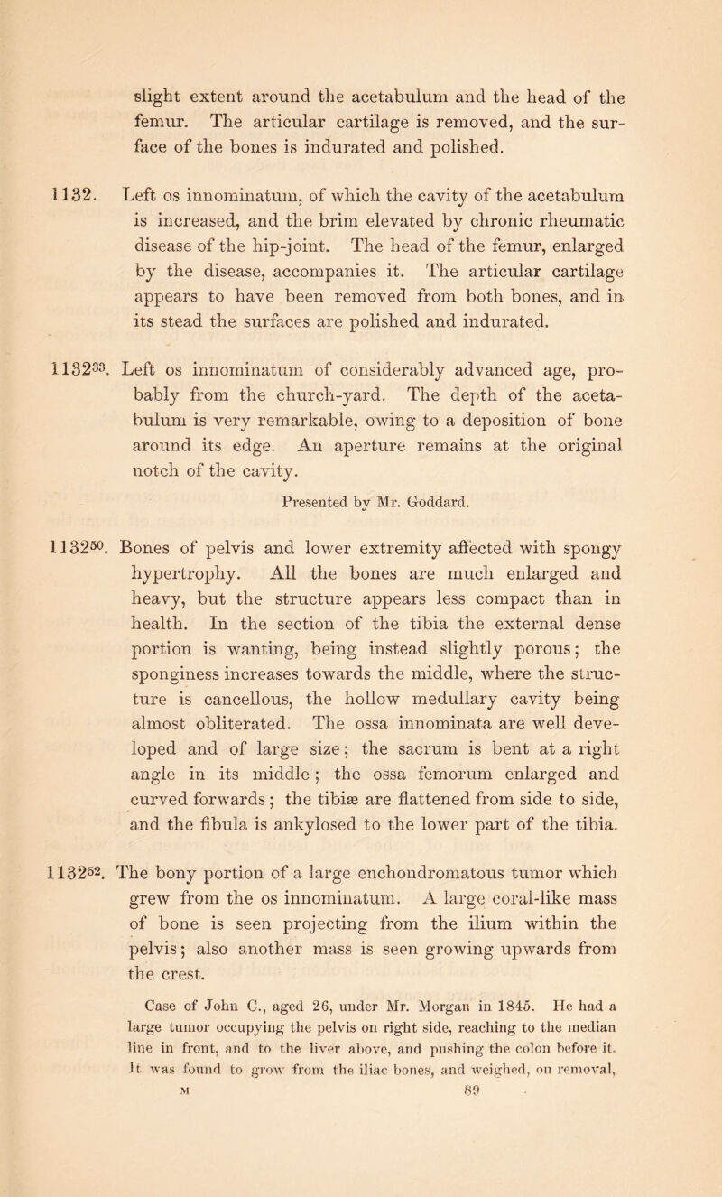 slight extent around the acetabulum and the head of the femur. The articular cartilage is removed, and the sur¬ face of the bones is indurated and polished. 1132. Left os innominatum, of which the cavity of the acetabulum is increased, and the brim elevated by chronic rheumatic disease of the hip-joint. The head of the femur, enlarged by the disease, accompanies it. The articular cartilage appears to have been removed from both bones, and in its stead the surfaces are polished and indurated. 113233. Left os innominatum of considerably advanced age, pro¬ bably from the church-yard. The depth of the aceta¬ bulum is very remarkable, owing to a deposition of bone around its edge. An aperture remains at the original notch of the cavity. Presented by Mr. Goddard. 113250. Bones of pelvis and lower extremity affected with spongy hypertrophy. All the bones are much enlarged and heavy, but the structure appears less compact than in health. In the section of the tibia the external dense portion is wanting, being instead slightly porous; the sponginess increases towards the middle, where the struc¬ ture is cancellous, the hollow medullary cavity being almost obliterated. The ossa innominata are well deve¬ loped and of large size; the sacrum is bent at a right angle in its middle ; the ossa femorum enlarged and curved forwards ; the tibiae are flattened from side to side, and the fibula is ankylosed to the lower part of the tibia. 113252. The bony portion of a large enchondromatous tumor which grew from the os innominatum. A large coral-like mass of bone is seen projecting from the ilium within the pelvis; also another mass is seen growing upwards from the crest. Case of John C., aged 26, under Mr. Morgan in 1845. He had a large tumor occupying the pelvis on right side, reaching to the median line in front, and to the liver above, and pushing the colon before it. It was found to grow from the iliac bones, and weighed, on removal,