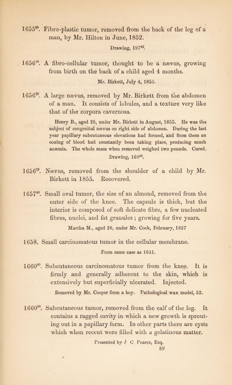 165580. Fibro-plastic tumor, removed from the back of the leg of a man, by Mr. Hilton in June, 1852. Drawing, 19 7 82. 165610. A fibro-cellular tumor, thought to be a nsevus, growing from birth on the back of a child aged 4 months. Mr. Birkett, July 4, 1855. 165620. A large nsevus, removed by Mr. Birkett from the abdomen of a man. It consists of lobules, and a texture very like that of the corpora cavernosa. Henry B., aged 25, under Mr. Birkett in August, 1855. He was the subject of congenital neevus on right side of abdomen. During the last year papillary subcutaneous elevations had formed, and from them an oozing of blood had constantly been taking place, producing much anaemia. The whole mass when removed weighed two pounds. Cured. Drawing, 16056. 165625. Nsevus, removed from the shoulder of a child by Mr. Birkett in 1855. Becovered. 165740. Small oval tumor, the size of an almond, removed from the outer side of the knee. The capsule is thick, but the interior is composed of soft delicate fibre, a few nucleated fibres, nuclei, and fat granules ; growing for five years. Martha M., aged 26, under Mr. Cock, February, 1857 1658. Small carcinomatous tumor in the cellular membrane. From same case as 1641. 166060. Subcutaneous carcinomatous tumor from the knee. It is firmly and generally adherent to the skin, which is extensively but superficially ulcerated. Injected. Bemoved by Mr. Cooper from a boy. Pathological wax model, 52. 166080. Subcutaneous tumor, removed from the calf of the leg. It contains a ragged cavity in which a new growth is sprout¬ ing out in a papillary form. In other parts there are cysts which when recent were filled with a gelatinous matter. Presented by J C„ Pearce, Esq.