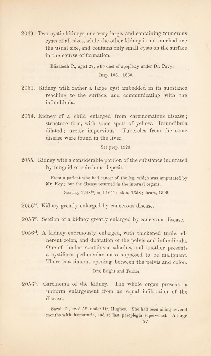 2049. Two cystic kidneys, one very large, and containing numerous cysts of all sizes, while the other kidney is not much above the usual size, and contains only small cysts on the surface in the course of formation. Elizabeth P., aged 27, who died of apoplexy under Dr. Pavy. Insp. 106. 1860. 2051. Kidney with rather a large cyst imbedded in its substance reaching to the surface, and communicating with the infundibula. 2054. Kidney of a child enlarged from carcinomatous disease; structure firm, with some spots of yellow. Infundibula dilated; ureter impervious. Tubercles from the same disease were found in the liver. See prep. 1923. 2055. Kidney with a considerable portion of the substance indurated by fungoid or scirrhous deposit. From a patient who had cancer of the leg, which was amputated by Mr. Key; but the disease returned in the internal organs. See leg, 124880, and 1641; skin, 1658; heart, 1399. 205624. Kidney greatly enlarged by cancerous disease. 205 636. Section of a kidney greatly enlarged by cancerous disease. 205648. A kidney enormously enlarged, with thickened tunic, ad¬ herent colon, and dilatation of the pelvis and infundibula. One of the last contains a calculus, and another presents a cystiform peduncular inass supposed to be malignant. There is a sinuous opening between the pelvis and colon. Drs. Bright and Turner. 205650. Carcinoma of the kidney. The whole organ presents a uniform enlargement from an equal infiltration of the disease. Sarah D., aged 58, under Dr. Hughes. She had been ailing several months with hsematuria, and at last pareplegia supervened. A large