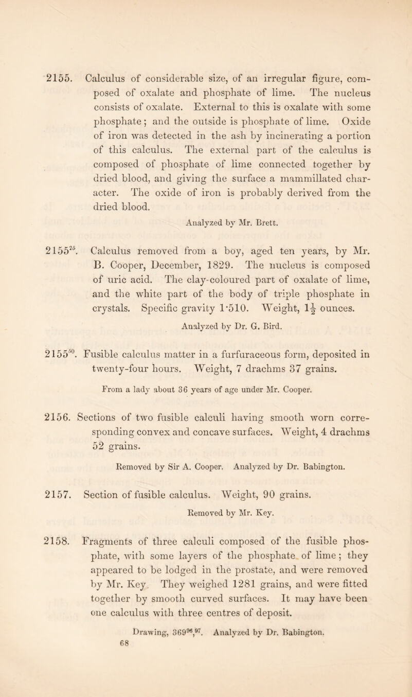 2155. Calculus of considerable size, of an irregular figure, com¬ posed of oxalate and phosphate of lime. The nucleus consists of oxalate. External to this is oxalate with some phosphate ; and the outside is phosphate of lime. Oxide of iron was detected in the ash by incinerating a portion of this calculus. The external part of the calculus is composed of phosphate of lime connected together by dried blood, and giving the surface a mammillated char¬ acter. The oxide of iron is probably derived from the dried blood. Analyzed by Mr. Brett. 215525. Calculus removed from a boy, aged ten years, by Mr. B. Cooper, December, 1829. The nucleus is composed of uric acid. The clay-coloured part of oxalate of lime, and the white part of the body of triple phosphate in crystals. Specific gravity D510. Weight, 1^ ounces. Analyzed by Dr. G. Bird. 2155''°. Fusible calculus matter in a furfaraceous form, deposited in twenty-four hours. Weight, 7 drachms 37 grains. From a lady about 36 years of age under Mr. Cooper. 2156. Sections of two fusible calculi having smooth worn corre¬ sponding convex and concave surfaces. Weight, 4 drachms 52 grains. Removed by Sir A. Cooper. Analyzed by Dr. Babington. 2157. Section of fusible calculus. Weight, 90 grains. Removed by Mr. Key. 2158. Fragments of three calculi composed of the fusible phos¬ phate, with some layers of the phosphate of lime ; they appeared to be lodged in the prostate, and were removed by Mr. Ivey. They weighed 1281 grains, and were fitted together by smooth curved surfaces. It may have been one calculus with three centres of deposit. Drawing, 3G 996,97. Analyzed by Dr. Babington.