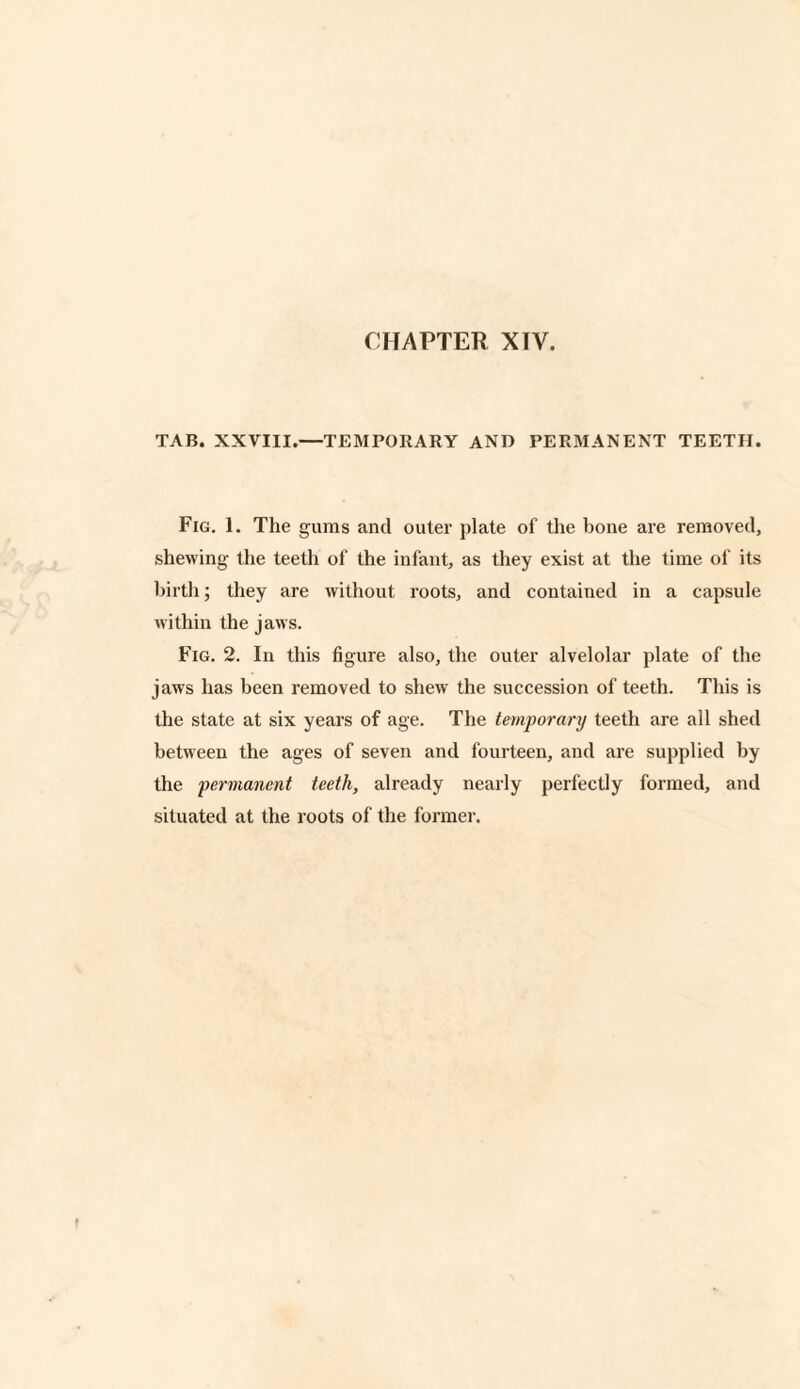 TAB. XXVIII.—TEMPORARY AND PERMANENT TEETH. Fig. 1. The gums and outer plate of the bone are removed, shewing the teeth of the infant, as they exist at the time of its birth; they are without roots, and contained in a capsule within the jaws. Fig. 2. In this figure also, the outer alvelolar plate of the jaws has been removed to shew the succession of teeth. This is the state at six years of age. The temporary teeth are all shed between the ages of seven and fourteen, and are supplied by the permanent teeth, already nearly perfectly formed, and situated at the roots of the former.