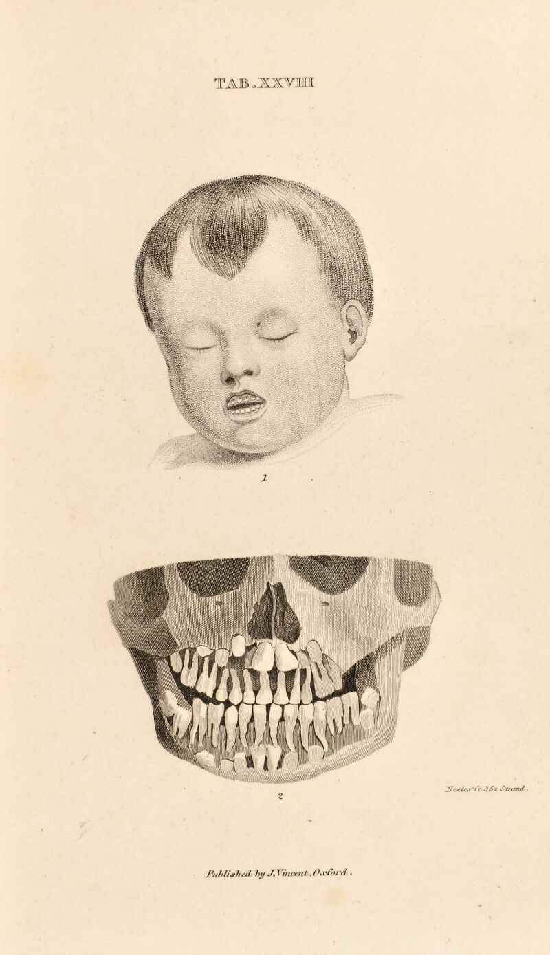 TAB ,,xxvmi Published by J. Vincent, O.viand .