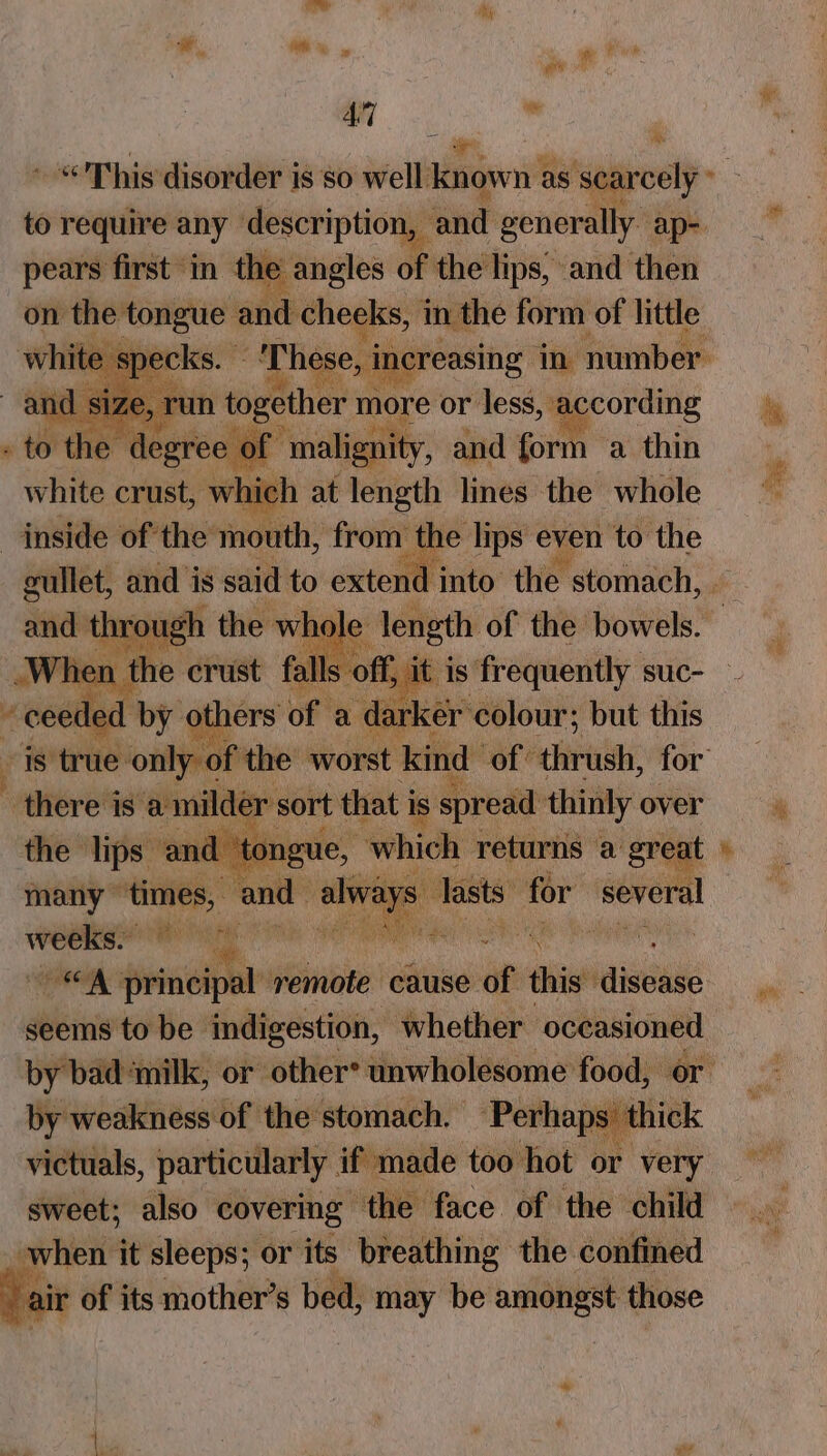 Ry ~ “This disorder is so well sagen as ‘scarcely * to require any description, ‘and generally. ap- pears first in the angles or the lips, and then on the tongue and cheeks, in the form of little and size, run together more or less, according . to the. degree of malignity, and form a thin white crust, which at length lines the whole inside ofthe mouth, from the lips even to the pawn and is said to extend 3 is reahgovee suc- ~ there is: a milder sort that i is spread: thinly over the lips and tor , many ‘times, and_ — ‘ cui for several pe re oils} Sia laine Saige principal remote cause of ai eons seems to be indigestion, whether occasioned by weakness of the stomach. — ‘Perhaps’ thick victuals, particularly. if made too hot or very sweet; also covering “the face of the child _when it sleeps; or its breathing the confined air of its mother’s bed, may be amongst those aa 2 ar