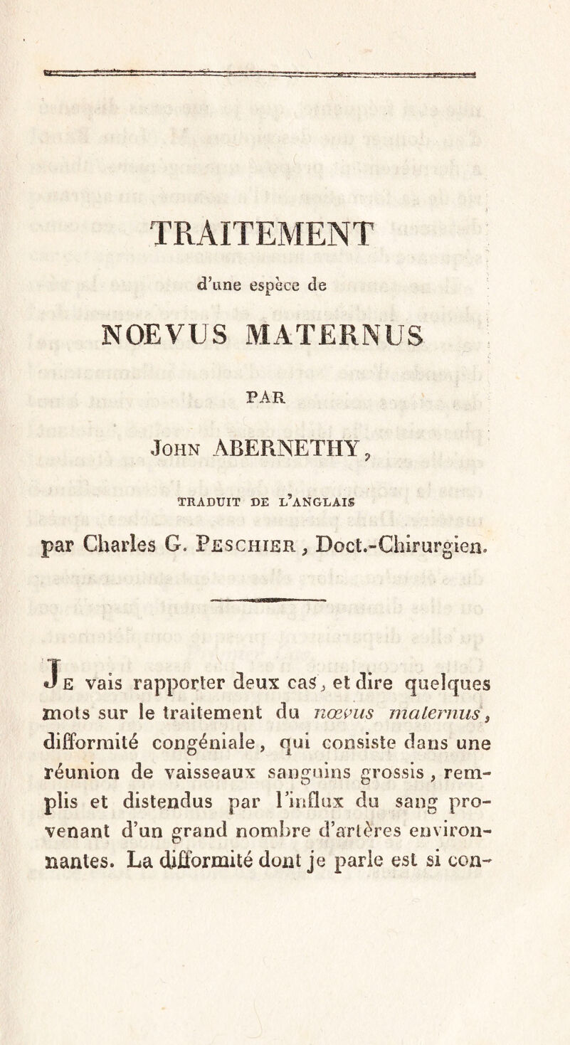 TRAITEMENT «d’une espèce de NOEVUS MATERNES PAR John ABERNETHY, TRADUIT DE D’ANGLAIS par Charles G. Feschier, Doct.-Chirurgien. JE vais rapporter deux cas ^ et dire quelques mots sur le traitement du nœvus malernus, difformité congéniale, qui consiste dans une réunion de vaisseaux sanguins grossis , rem¬ plis et distendus par l'influx du sang pro¬ venant d’un grand nombre d’artères environ¬ nantes. La difformité dont je parle est si con-