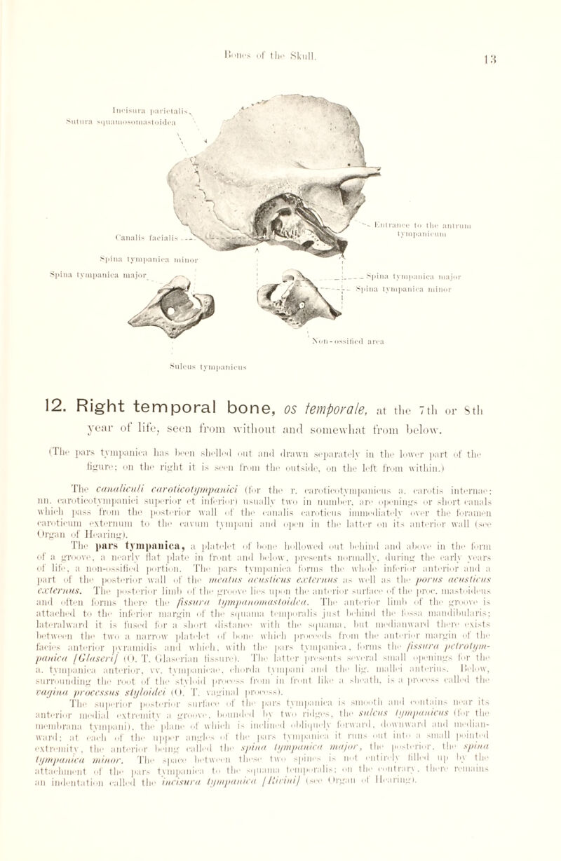 I*'’Hi's of thi' Skull. Non - ossified area Canalis facialis — spina tympanica minor Spina tympanica major _Spina tympanica major Spina tympanica minor Incisura pariotalis^ Sutura squamosomastoidca \ A Sulcus tympanicus 12. Right temporal bone, os toniporolB, at the 7th or sth year of life, seen from without and somewhat from below. (The pars tympanica has been shelleil out and drawn separately in the lower part of the figure; on the right it is seen from the outside, on the left from within.) The canaliculi caroticotympanici (for the r. caroticotvmpanicus a. earotis internae: nn. caroticotympanici superior ot inferior) usually two in number, are openings or short canals which pass from the posterior wall of the canalis camticus immediately over the foramen caroticum externum to the cavum tympani and open in the latter on its anterior wall (see Organ of Hearing). The pars tympanica, a platelet of hone hollowed out behind and above in the form of a groove, a nearly flat plate in front and below, presents normally, during the early years of life, a non-ossified portion. The pars tympanica forms the whole inferior anterior and a part of the posterior wall of the meatus acusticus externus as well as the poms acusticus externus. The posterior limb of the groove lies upon the anterior surface of the proe. mastoideus and often forms there the fissura iympanomastoidea. The anterior limb of the groove is attached to the inferior margin of the squama temporalis just behind the fossa mandibularis; lateralward it is fused for a short distance with the sijuama. but median ward there exists between the two a narrow platelet of hone which proceeds from the anterior margin of the facies anterior pyramidis and which, with the pars tympanica, forms tlm [issuru petrotym- panica [GInsert/ (0. T. Glaserian fissure). The latter presents several small openings lor the a. tympanica anterior, vv. tvinpanicae, chorda tympani and the lig. mallei anterius. Helow, surrounding the root of the stvloid process from in front like a sheath, is a process called the vagina processus siyloulei (O. T. vaginal jiroeess). The superior posterior surface of the pars tympanica is smooth and contains near its anterior medial extremitx a groove, hounded I»v two ridges, the sulcus tympanums (tor the memhrana tvinpani), the plane of which is inclined obliquely lorward, downward and median- ward: at each of the upper angles of the pars tympanica it runs out into a small pointed extremity, the anterior being called the spina tympanica major, the posterior, the spina tympanica minor. The space between these two spines i.- not entiivlx filled up I',' the attachment of the pars tvmpaniea to the sipiama temporalis: on the eontrirx . there remains an indentation called the incisura tympanica [liiciui] (see Organ ol Haringi.