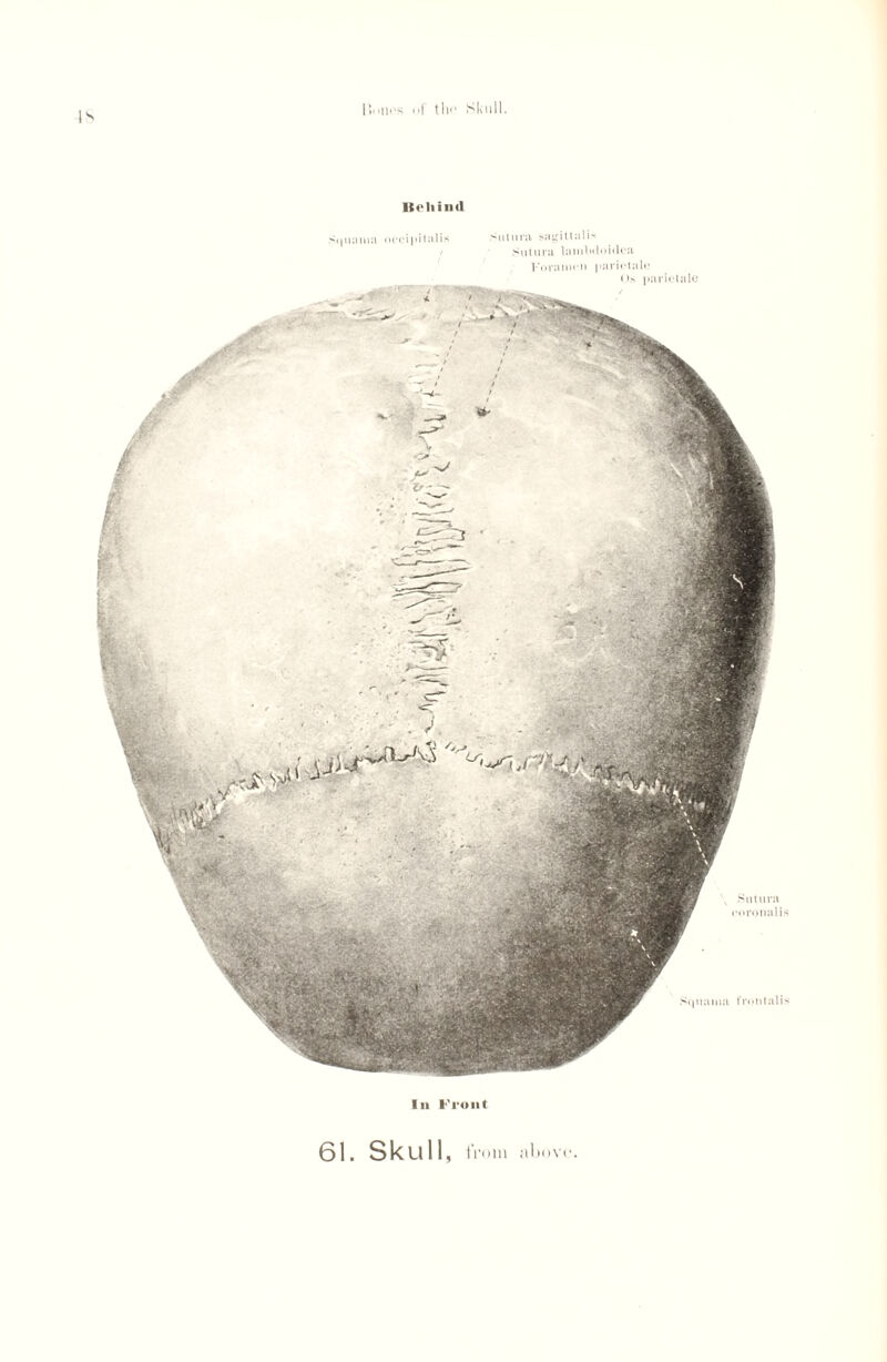 IS Kelli ml Squama occipitalis >wtura sagittal is Sutura lamlaloklea Foramen parietale Os parietalc Squama frontalis , Sutura coronalis In Front 61. Skull, from above*