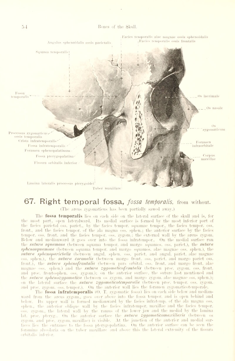 Annulus split noi<la 1 is ossis parietalis Facies temporalis alae magnae ossis sphenoidalis (Facie- temporalis ossis frontalis P lac rimale Os nasalc Os zygomat ieum rocesstis zygomatietis' ossis temporalis < Tista infratemporali.-  Fossa in fra temporal is  Foramen sphenopalatinnm Fossa ptorygopalatina^ Fissura orbitalis inferior Lamina lateral!- processus ptorygoidei Tuber maxillare F ora men infraorbitale Squama temporalis Fossa temporalis 67. Right temporal fossa, fossa temporalis, from without. (The arcus zygomatieus Lias been partially sawed away.) The fossa temporalis lies on each side on the lateral surface of the skull and is, for the most part, open lateralward. Its medial surface is funned by the most inferior part of the facies parietal oss. pariet., In the facies temper, squamae temper., the facies temper, oss. front., and the facies temper, of the ala magna os>. .sphen.; the anterior surface by the facies temper, oss. front, and the facies temper, oss. zygom.: the external wall by the arcus zygom. Heluw and medianward it goes over into the fossa infratempor.. On the medial surface run tic sutura squamosa (between squama tempor. and marge squanios. oss. pariet.), 111« sutura sphenosquamosa (between squama temper, and marge squanios. alae magnae oss. sphen.l, the sutura sphenoparietalis (between angul. sphen. oss. pariet. and angul. pariet. alae magnae oss. sphen.l, the sutura coronalis (between margo front, oss. pariet. and margo pariet oss. front.), the sutura sphenofrontalis (between pars orbital. os.«. front, and margo front, alae magnae oss. sphen.) and the sutura zyyomaticofrontalis (between proc. zygom. oss. front, and proc. frontosphen. oss. zygom.); on the anterior surface, the suture last mentioned and tlie sutura sphenozygomatica (between os zygom. and margo zygom. alae magnae oss. sphen.); mi the lateral surface the sutura zygomaticotemporalis (between proc. tempor. oss. zygom. and proc. zygom. oss. tempor.). On the anterior wall lies the foramen zygomatieotemporale. The fossa infratemporal is (O. T. zygomatic fossa) lies on each side below and median- ward from the arcus zvgom., goes over above into the fossa tempor. and is open behind and below. Its upper wall is formed medianward by the lacies intratemp, ot (lie ala magna oss. sphen., the anterior oblique wall b\ the facies infratempor. maxillae and the lacies tempor. oss. zygom., the lateral wall by the ramus of the lower jaw and the medial by the lamina lat. proc. ptervg.. On the anterior surface the sutura zygomaticoma.villaris (between os zvgom. and proc. zvgom. maxillae) i> visible. At the junction ot the anterior and medial -ur- faees lies the entrance to the fossa ptervgopalatina. < hi the anterior surtace can be seen the foramina alveolaria on the tuber maxillare and above this the lateral extremity of the fissura orbitalis inferior.