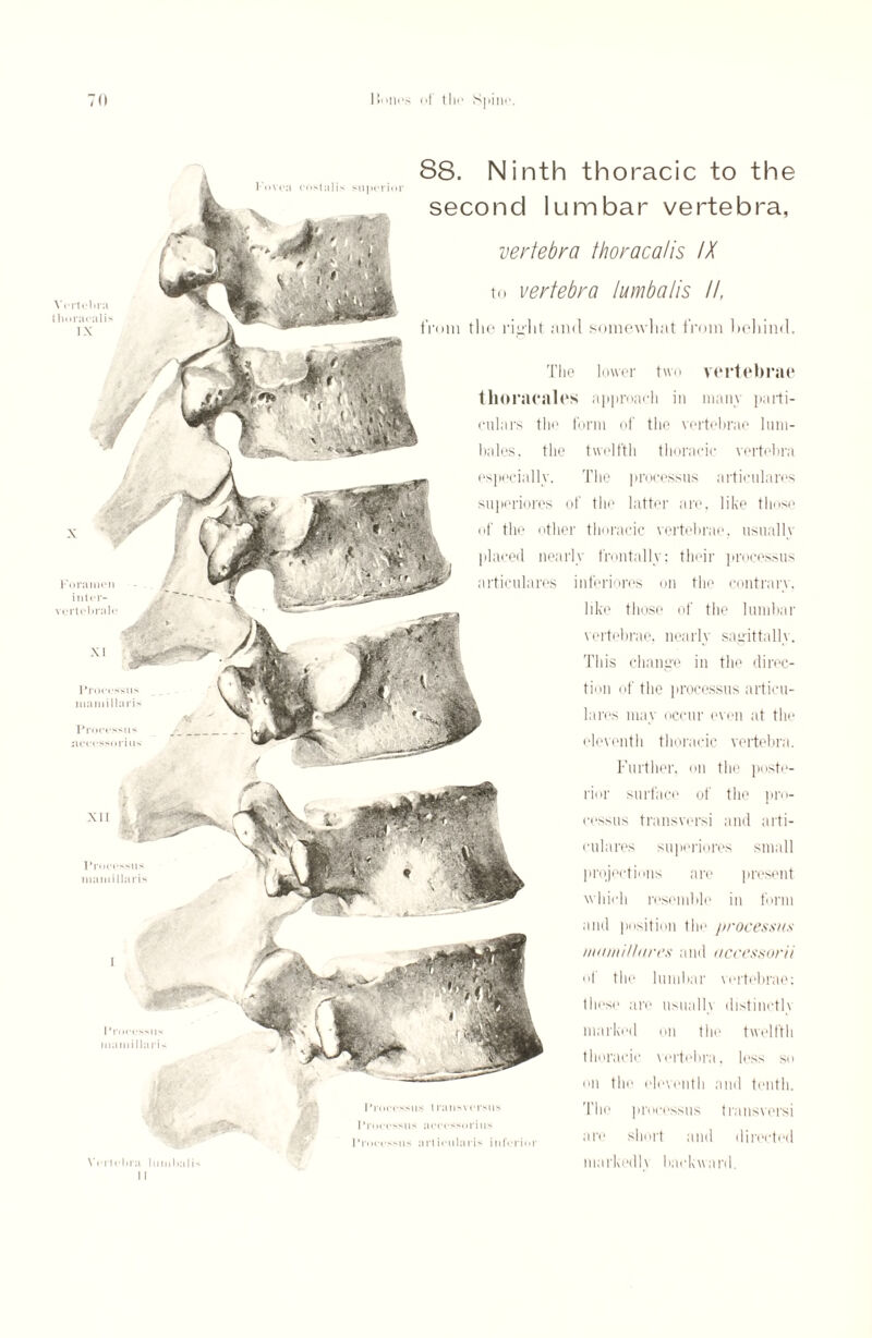 88. Ninth thoracic to the second lumbar vertebra, vertebra thoracatis IX to vertebra lumbalis II, from the right and somewhat from behind. The lower two vertebrae tlioraeales approach in many parti¬ culars the form of the vertebrae 1 um- bales, the twelfth thoracic vertebra especially. The processus articulares superiores of the latter are, like those of the other thoracic vertebrae, usually placed nearly frontally; their processus articulares inferiores on the contrary. like those of the lumbar vertebrae, nearly sagittally. This change in the direc¬ tion of the processus articu¬ lares may occur even at the eleventh thoracic vertebra. Further, on the poste¬ rior surface of the pro¬ cessus transversi and arti¬ culares superiores small projections are present which resemble in form and position the processus mamillares and accessor// of the lumbar vertebrae; these are usually distinctly marked on the twelfth thoracic vertebra, less so on the eleventh and tenth. The processus transversi are short and directed markedly haekward. Vertebra thoraealis IX Foramen inter- vcrtebralc Processus mamillaris Processus accessorius