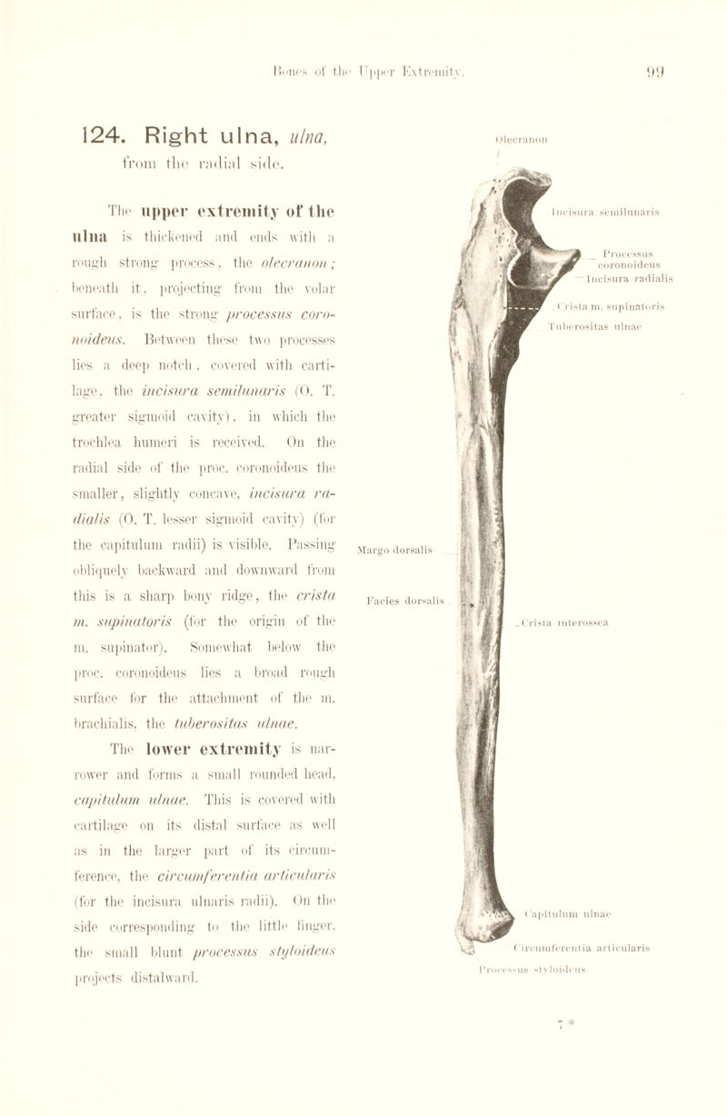 I$nnos of tho I |>jh-l- Kxtrcmitv. ‘I'J 124. Right ulna, ulna, from tho radial side. The upper extremity of the ulna is thickened and ends with a rough strong process, the olecranon; beneath it, projecting from tho volar surface, is the strong processus coro¬ noideus. Between these two processes lies a deep notch . covered with carti¬ lage, the incisura semilunaris (0. T. greater sigmoid cavity). in which the trochlea humeri is received. On the radial side of the proc. coronoideus the smaller, slightly concave, incisura ra- dia/is (0. T. lesser sigmoid cavity) (for the capitulum radii) is visible. Passing obliquely backward and downward from this is a sharp bony ridge, the crista, rn. supinatoris (for the origin of the m. supinator). Somewhat below the proc. coronoideus lies a broad rough surface for the attachment of the m. brachialis, the tuberositas ulnae. The lower extremity is nar¬ rower and forms a small rounded head, capitulum ulnae. This is covered with cartilage on its distal surface as well as in the larger part of its circum¬ ference, the circumferentia articular is (for the incisura ulnaris radii). On the side corresponding to tho little linger, the small blunt processus styloideus projects distalward. Olecranon )