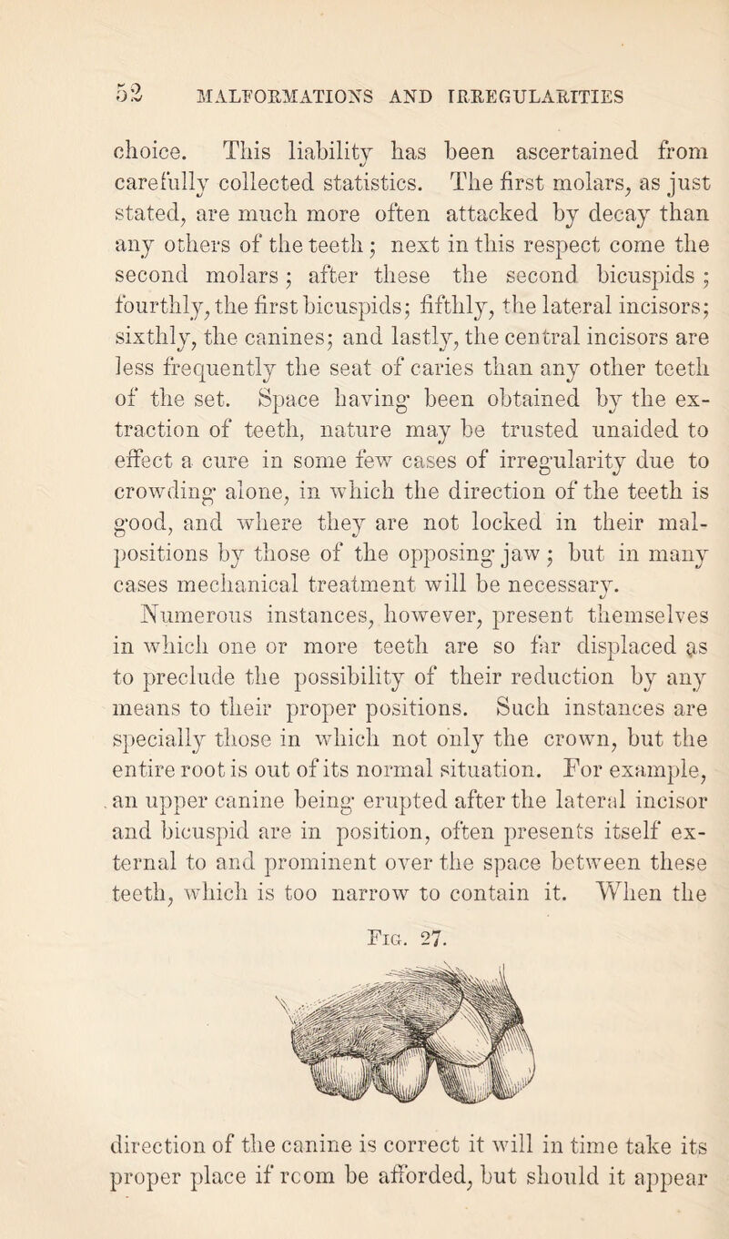 rn choice. This liability has been ascertained from carefully collected statistics. The first molars, as just stated, are much more often attacked by decay than any others of the teeth ; next in this respect come the second molars; after these the second bicuspids ; fourthly, the first bicuspids- fifthly, the lateral incisors; sixthly, the canines; and lastly, the central incisors are less frequently the seat of caries than any other teeth of the set. Space having- been obtained by the ex¬ traction of teeth, nature may be trusted unaided to effect a cure in some few cases of irregularity due to crowding alone, in which the direction of the teeth is good, and where they are not locked in their mal¬ positions by those of the opposing jaw; but in many cases mechanical treatment will be necessary. Numerous instances, however, present themselves in which one or more teeth are so far displaced 51s to preclude the possibility of their reduction by any means to their proper positions. Such instances are specially those in which not only the crown, but the entire root is out of its normal situation. For example, an upper canine being erupted after the lateral incisor and bicuspid are in position, often presents itself ex¬ ternal to and prominent over the space between these teeth, which is too narrow to contain it. When the Fig. 27. direction of the canine is correct it will in time take its proper place if room be afforded, but should it appear