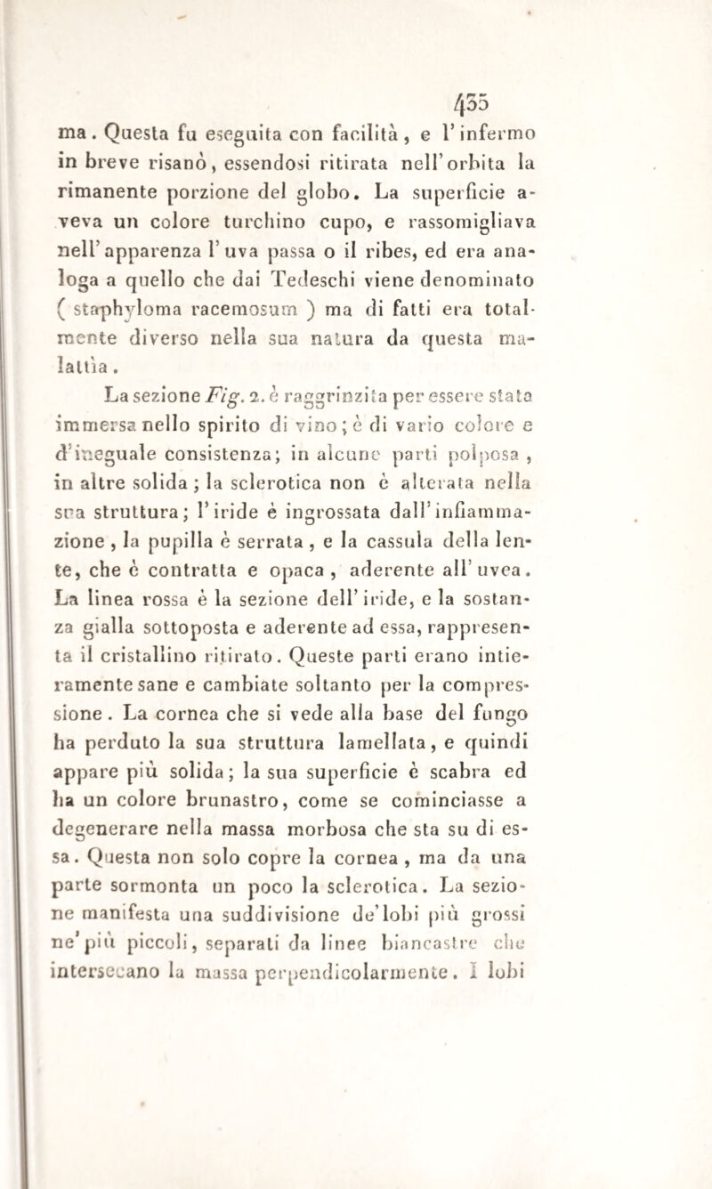 ma. Questa fu eseguita con facilità, e l’infermo in breve risanò, essendosi ritirata nell’orbita la rimanente porzione del globo. La superfìcie a- veva un colore turchino cupo, e rassomigliava nell’apparenza l’uva passa o il ribes, ed era ana¬ loga a quello che dai Tedeschi viene denominato ( staphyloma racemosum ) ma di fatti era total¬ mente diverso nella sua natura da questa ma¬ lattia . La sezione Fig. 2. è raggrinzita per essere stato immersa nello spirito di vino; è di vario colore e d ineguale consistenza; in alcune parti polposa , in altre solida; la sclerotica non è alterala nella sua struttura; l’iride è ingrossata dall’infiamma¬ zione , la pupilla è serrata , e la cassida della len¬ te, che è contratta e opaca, aderente all’uvea. La linea rossa è la sezione dell’iride, e la sostan¬ za gialla sottoposta e aderente ad essa, rappresen¬ ta il cristallino ritirato. Queste parti erano intie¬ ramente sane e cambiate soltanto per la compres¬ sione . La cornea che si vede alia base del fungo ha perduto la sua struttura lamellata, e quindi appare più solida ; la sua superficie è scabra ed ha un colore brunastro, come se cominciasse a degenerare nella massa morbosa che sta su di es¬ sa. Questa non solo copre la cornea , ma da una parte sormonta un poco la sclerotica. La sezio¬ ne manifesta una suddivisione de’lobi più glossi ne’più piccoli, separati da linee biancastre che intersecano la massa perpendicolarmente. I lobi