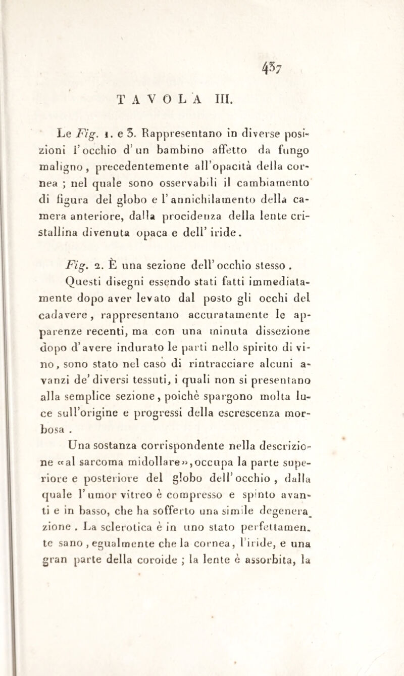 TAVOLA III. Le Fig. i. e 5. Rappresentano in diverse posi* zioni i’occhio d un bambino affetto da fungo maligno, precedentemente all’opacità della cor¬ nea ; nel quale sono osservabdi il cambiamento di figura del globo e V annichilamento della ca¬ mera anteriore, dalla procidenza della lente cri¬ stallina divenuta opaca e dell’iride. Fig. 2. È una sezione dell’occhio stesso . Questi disegni essendo stati fatti immediata¬ mente dopo aver levato dal posto gli occhi del cadavere, rappresentano accuratamente le ap¬ parenze recenti, ma con una minuta dissezione dopo d’avere indurato le parti nello spirito di vi¬ no, sono stato nel caso di rintracciare alcuni a- vanzi de’diversi tessuti, i quali non si presentano alla semplice sezione, poiché spargono molta lu¬ ce sull’origine e progressi della escrescenza mor¬ bosa . Una sostanza corrispondente nella descrizio¬ ne «al sarcoma midollare»,occupa la parte supe¬ riore e posteriore del globo dell’occhio, dalla quale 1’umor vitreo è compresso e spinto avan¬ ti e in basso, che ha sofferto una simi le d egenera_ zione . La sclerotica é in uno stato perfetlamen. te sano , egualmente che la cornea, l inde, e una gran parte della coroide ; la lente é assorbita, la