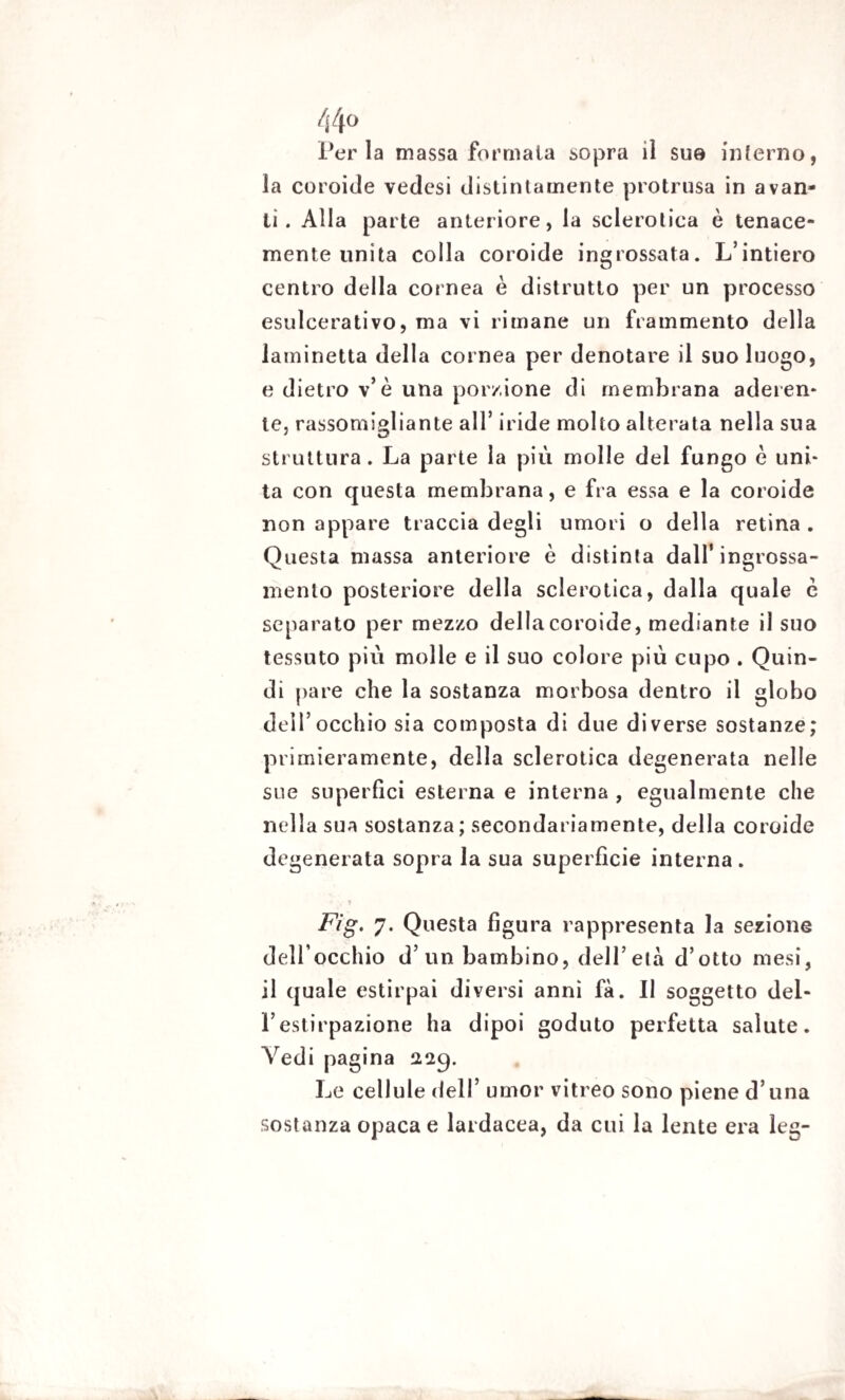 Per la massa formala sopra il sua interno, la coroide vedesi distintamente protrusa in avan¬ ti. Alla parte anteriore, la sclerotica è tenace¬ mente unita colla coroide ingrossata. L’intiero centro della cornea è distrutto per un processo esulcerativo, ma vi rimane un frammento della laminetta della cornea per denotare il suo luogo, e dietro v’è una porzione di membrana aderen* te, rassomigliante all’ Ìride molto alterata nella sua struttura. La parte la più molle del fungo è uni* ta con questa membrana, e fra essa e la coroide non appare traccia degli umori o della retina . Questa massa anteriore è distinta dall’ingrossa¬ mento posteriore della sclerotica, dalla quale è separato per mezzo della coroide, mediante il suo tessuto più molle e il suo colore più cupo . Quin¬ di pare che la sostanza morbosa dentro il globo dell’occhio sia composta di due diverse sostanze; primieramente, della sclerotica degenerata nelle sue superfici esterna e interna , egualmente che nella sua sostanza ; secondariamente, della coroide degenerata sopra la sua superfìcie interna. * .• > Fìg. 7. Questa figura rappresenta la sezione dell occhio d’un bambino, dell’età d’otto mesi, il quale estirpai diversi anni fa. Il soggetto del¬ l’estirpazione ha dipoi goduto perfetta salute. Vedi pagina 229. Le cellule dell’ umor vitreo sono piene d’una sostanza opaca e lardacea, da cui la lente era leg-