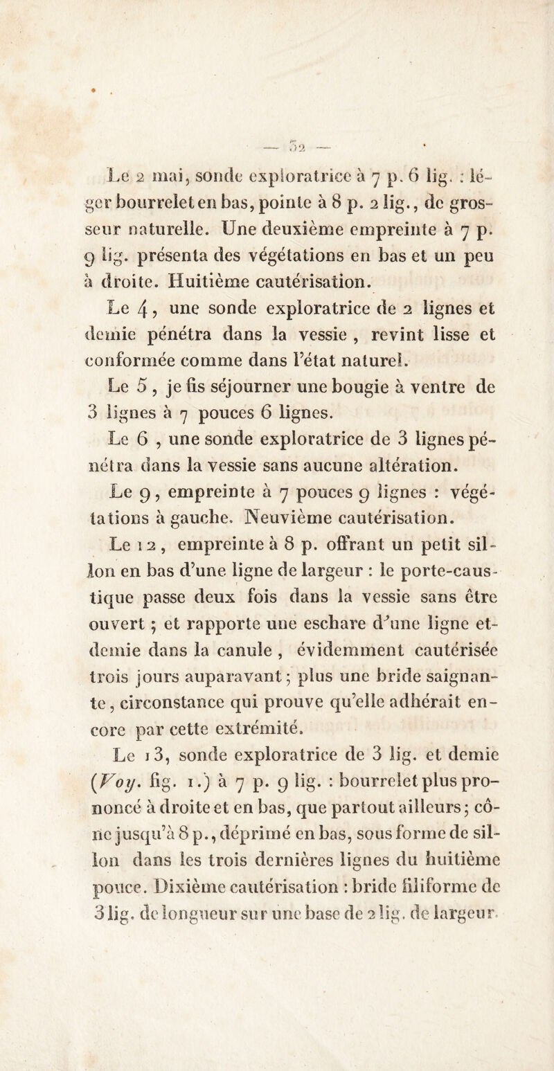 ger bourrelet en bas, pointe à 8 p. 2 lig., de gros¬ seur naturelle. Une deuxième empreinte à 7 p. 9 lig. présenta des végétations en bas et un peu à droite. Huitième cautérisation. Le 4 ? sonde exploratrice de 2 lignes et demie pénétra dans la vessie , revint lisse et conformée comme dans l’état naturel. Le 5, je fis séjourner une bougie à ventre de 3 lignes à 7 pouces 6 lignes. Le 6 , une sonde exploratrice de 3 lignes pé¬ nétra dans la vessie sans aucune altération. Le 9, empreinte à 7 pouces 9 lignes : végé¬ tations à gauche. Neuvième cautérisation. Le 12 , empreinte à 8 p. offrant un petit sil¬ lon en bas d’une ligne de largeur : le porte-caus- 1 tique passe deux fois dans la vessie sans être ouvert ; et rapporte une eschare dLine ligne et- deniie dans la canule , évidemment cautérisée trois jours auparavant 5 plus une bride saignan¬ te, circonstance qui prouve qu’elle adhérait en¬ core par cette extrémité. Le j 3, sonde exploratrice de 3 lig. et demie (Voy. fig. 1.) à 7 p. 9 îig. : bourrelet plus pro¬ noncé à droite et en bas, que partout ailleurs ; cô¬ ne jusqu’à 8 p., déprimé en bas, sous forme de sil¬ lon dans les trois dernières lignes du huitième pouce. Dixième cautérisation : bride filiforme de 3 lig. de longueur sur une hase de 2 lig. de largeur