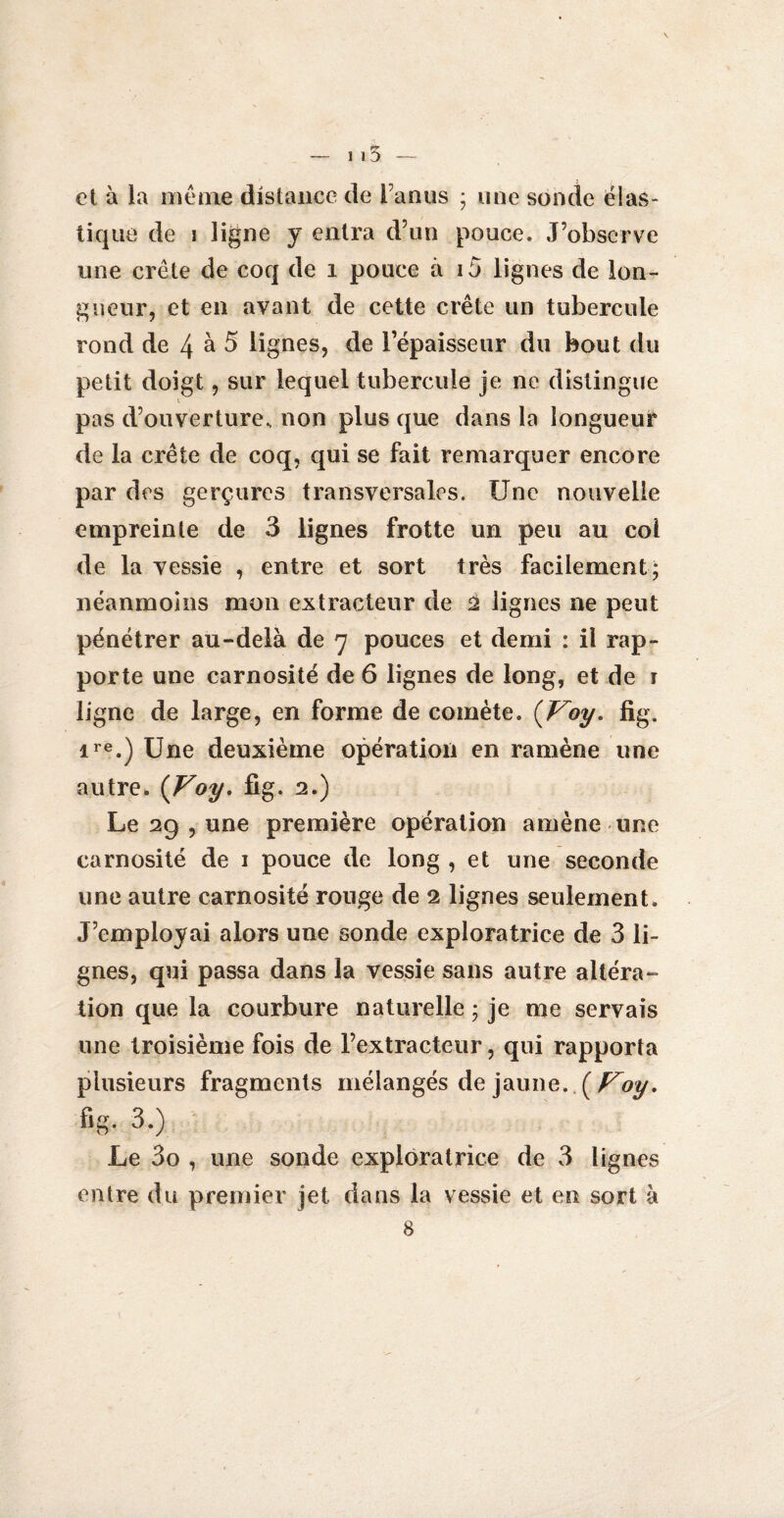 115 — et à la meme distance de Tamis ; une sonde élas¬ tique de i ligne y entra d’un pouce. J’observe une crête de coq de i ponce à i5 lignes de lon¬ gueur, et en avant de cette crête un tubercule rond de 4 à 5 lignes, de l’épaisseur du bout du petit doigt, sur lequel tubercule je ne distingue V pas d’ouverture., non plus que dans la longueur de la crête de coq, qui se fait remarquer encore par des gerçures transversales. Une nouvelle empreinte de 3 lignes frotte un peu au col de la vessie , entre et sort très facilement; néanmoins mon extracteur de 2 lignes ne peut pénétrer au-delà de 7 pouces et demi : il rap¬ porte une carnosité de 6 lignes de long, et de 1 ligne de large, en forme de comète. (Voy. fig. ire.) Une deuxième opération en ramène une autre. (Voy. fig. 2.) Le 29 , une première opération amène une carnosité de 1 pouce de long , et une seconde une autre carnosité rouge de 2 lignes seulement. J’employai alors une sonde exploratrice de 3 li¬ gnes, qui passa dans la vessie sans autre altéra¬ tion que la courbure naturelle ; je me servais une troisième fois de l’extracteur, qui rapporta plusieurs fragments mélangés de jaune. ( Voy. fig. 3.) Le 3o , une sonde exploratrice de 3 lignes entre du premier jet dans la vessie et en sort à