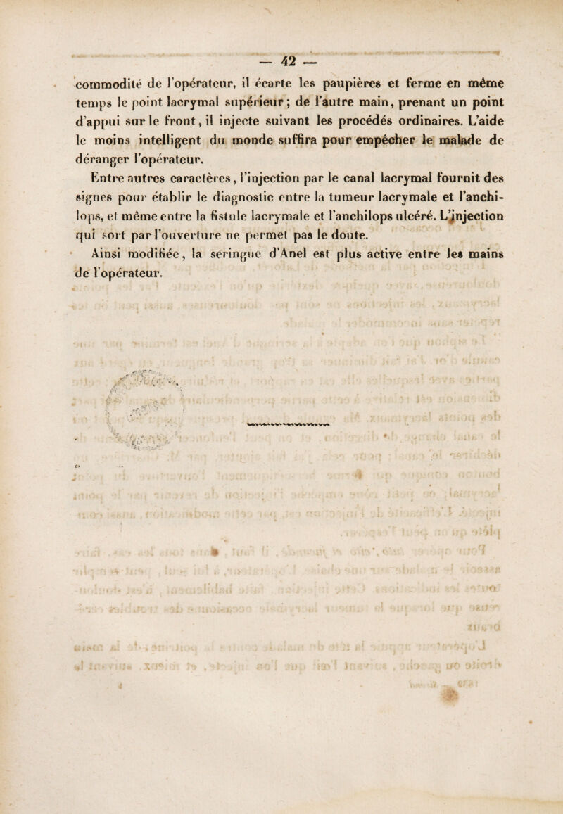 — 42 commodité de l’opérateur, il écarte les paupières et ferme en même temps le point lacrymal supérieur; de l’autre main, prenant un point d’appui sur le front, il injecte suivant les procédés ordinaires. L’aide le moins intelligent du monde suffira pour empêcher le malade de déranger l’opérateur. Entre autres caractères, l’injection par le canal lacrymal fournit des signes pour établir le diagnostic entre la tumeur lacrymale et l’anchi- lops, et même entre la fistule lacrymale et l’anchilops ulcéré. L’jnjection qui sort parTouverture ne permet pas le doute. Ainsi modifiée , la .seringue d’Anel est plus active entre les mains de l’opérateur. e. ,r>- ^ \ ■ . J) ■ •‘•.'f -,