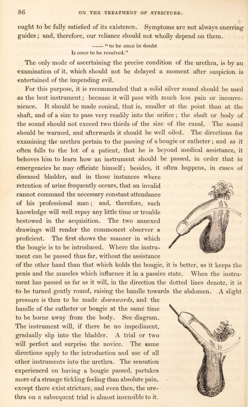 ought to be fully satisfied of its existence. Symptoms are not always unerring guides; and, therefore, our reliance should not wholly depend on them. “ to be once in doubt Is once to be resolved.” The only mode of ascertaining the precise condition of the urethra, is by an examination of it, which should not be delayed a moment after suspicion is entertained of the impending evil. For this purpose, it is recommended that a solid silver sound should be used as the best instrument; because it will pass with much less pain or inconve- nience. It should be made conical, that is, smaller at the point than at the shaft, and of a size to pass very readily into the orifice; the shaft or body of the sound should not exceed two thirds of the size of the canal. The sound should be warmed, and afterwards it should be well oiled. The directions for examining the urethra pertain to the passing of a bougie or catheter; and as it often falls to the lot of a patient, that he is beyond medical assistance, it behoves him to learn how an instrument should be passed, in order that in emergencies he may officiate himself; besides, it often happens, in cases of diseased bladder, and in those instances where retention of urine frequently occurs, that an invalid cannot command the necessary constant attendance of his professional man; and, therefore, such knowledge will well repay any little time or trouble bestowed in the acquisition. The two annexed drawings will render the commonest observer a proficient. The first shows the manner in which the bougie is to be introduced. Where the instru- ment can be passed thus far, without the assistance of the other hand than that which holds the bougie, it is better, as it keeps the penis and the muscles which influence it in a passive state. When the instru- ment has passed as far as it will, in the direction the dotted lines denote, it is to be turned gently round, raising the handle towards the abdomen. A slight pressure is then to be made downwards, and the handle of the catheter or bougie at the same time to be borne away from the body. See diagram. The instrument will, if there be no impediment, gradually slip into the bladder. A trial or two will perfect and surprise the novice. The same directions apply to the introduction and use of all other instruments into the urethra. The sensation experienced on having a bougie passed, partakes more of a strange tickling feeling than absolute pain, except there exist stricture, and even then, the ure- thra on a subsequent trial is almost insensible to it. i