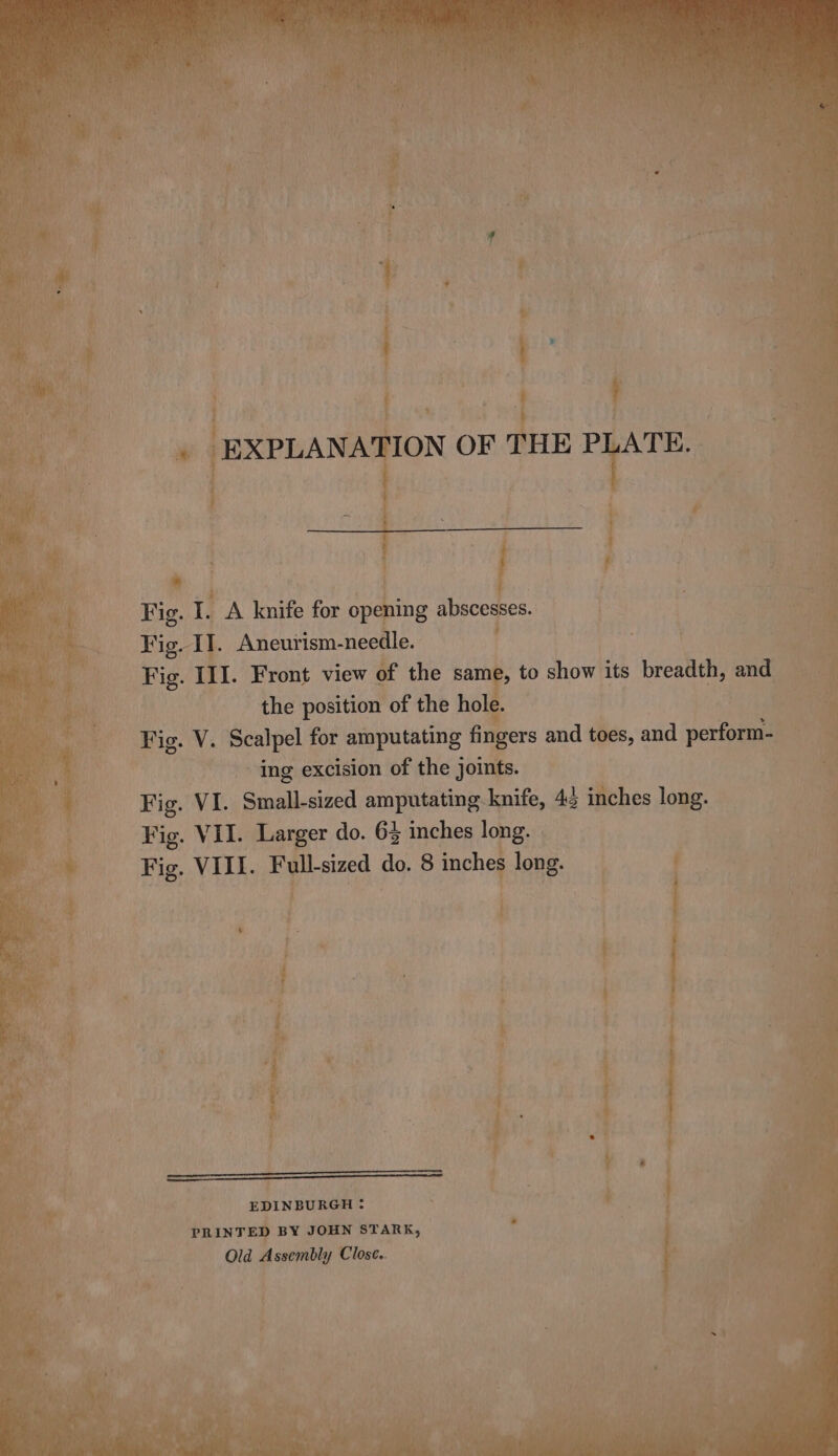 di bs | , a i * Fig. 1 A knife for 2 abscesses. Fig. I. Aneurism-needle. one pea Fig. III. Front view of the same, to show its breadth, aie B: the position of the hole : as - Fig. V. Scalpel for amputating Hgers and toes, and verte , ing excision of the joints. Fig. VI. ‘Small-sized amputating knife, 42 inches long: Fig. VII. Larger do. 63 inches lone Fig. VIII. Full-sized de 8 inches long. \ Aer ON : EDINBURGH : PRINTED BY JOHN STARK, Old Assembly Close..